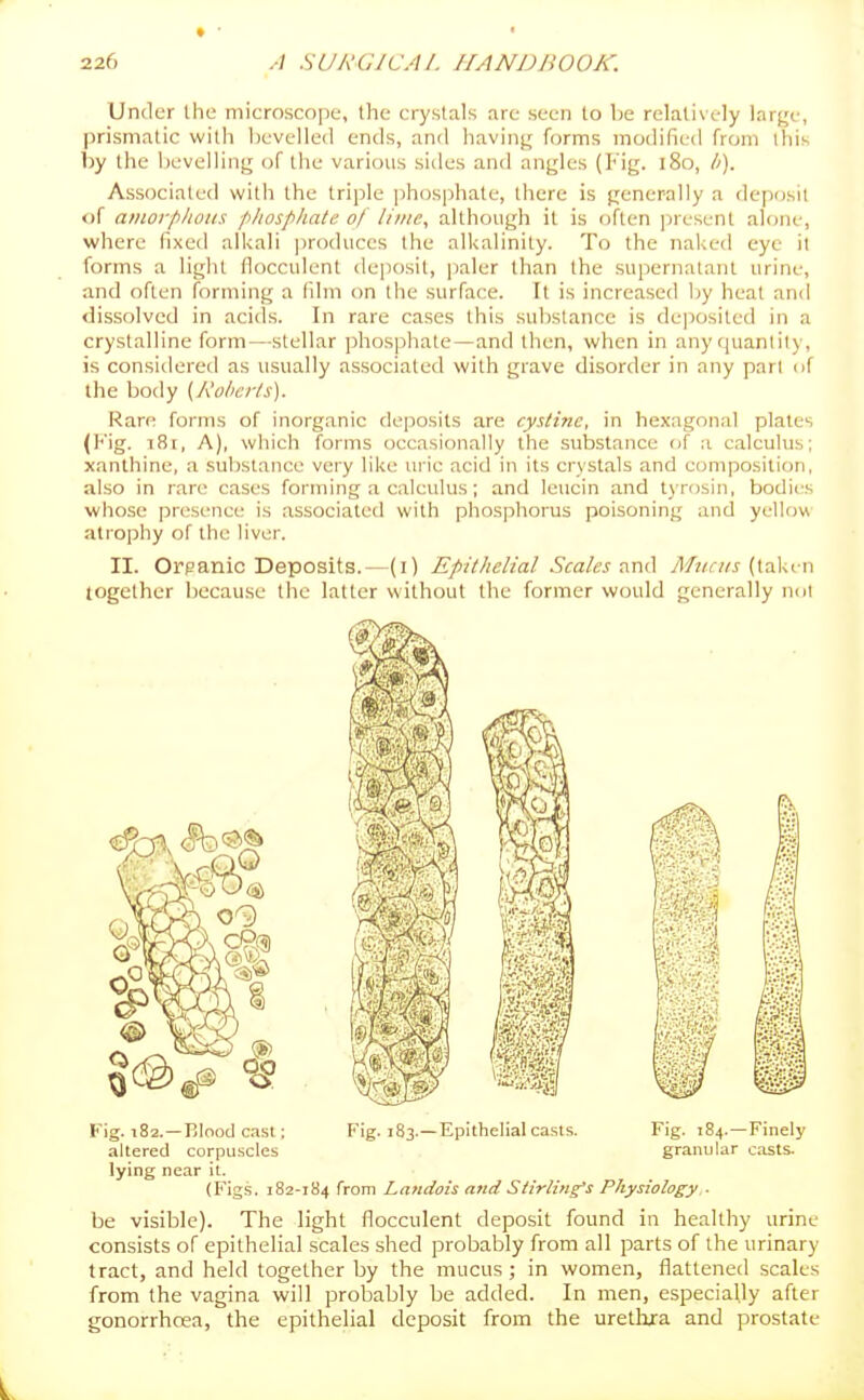Under the microscope, the crystals are seen to be relatively large, prismatic with bevelled ends, and having; forms modified from this by the bevelling of the various sides and angles (I'ig. i8o, //). Associated with the triple ])hosphale, there is generally a deposit of amoi-phons phosphate of lime, although it is often present alone, where fixed alkali ])roduces the alkalinity. To the naked eye it forms a light flocculent deposit, paler than the supernatant urine, and often forming a fdm on the surface. It is increased by heat and dissolved in acids. In rare cases this sul)stance is de]iosiled in a crystalline form—stellar phosphate—and then, when in any tjuanlity, is consitlered as usually associated with grave disorder in any pari of the body {Roheiis). Rare forms of inorganic deposits are cystine, in hexagonal plates (Kig. i8r, A), which forms occasionally the substance of a calculus; xanthine, a substance very like uric acid in its crystals and composition, also in rare cases forming a calculus; and leucin and tyrosiii, bodies whose presence is associated with phosphorus poisoning and yellovv atrophy of the liver. II. Organic Deposits.—(i) Epithelial Scales yl/?/r//j-(taken together because the latter without the former would generally not Kig. 182. —Plood cast; Fig. 183.—Epithelial casts. Fig. 184.—Finely altered corpuscles granular c.asts. lying near it. (Figs. 182-184 from Landois atid Stirling's Physiology . be visible). The light flocculent deposit found in healthy urine consists of epithelial scales shed probably from all parts of the urinary tract, and held together by the mucus; in women, flattened scales from the vagina will probably be added. In men, especially after gonorrhoea, the epithelial deposit from the urethxa and prostate