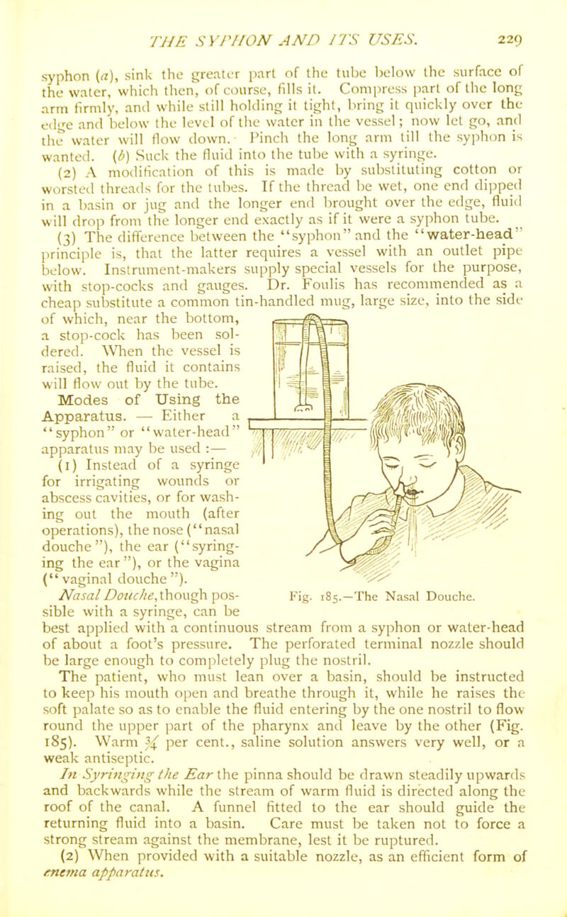 syphon (a), sink the greater part of the tube l)elow the surface of the water, which then, of course, fills it. Compress part of the long arm firmly, and while still holding it tight, bring it quickly over the edge and below the level of tlie water in the vessel; now let go, and the water will flow down. Pinch the long arm till the .syphon is wanted. {/-■) Suck the fluid into the tube with a syringe. (2) A modification of this is made by .substituting cotton or worsted threads for the tubes. If the thread be wet, one end dijiped in a basin or jug and the longer end brought over the edge, fluid will drop from the longer end exactly as if it were a syphon tube. (3) The difference between the .syphon and the water-head principle is, that the latter requires a vessel with an outlet pipe below. Instrument-makers supply special vessels for the purpose, wth stop-cocks and gauges. Dr. Foulis has recommended as a cheap substitute a common tin-handled mug, large size, into the side of which, near the bottom, a stop-cock has been sol- dered. \Vhen the vessel is raised, the fluid it contains will flow out by the tube. Modes of Using the Apparatus. — Either a syphon or water-head apparatus may be used :— (1) Instead of a syringe for irrigating wounds or abscess cavities, or for wash- ing out the mouth (after operations), the nose (nasal douche), the ear (syring- ing the ear ), or the vagina (vaginal douche ). Nasal Z'i7«<r//e, though pos- sible with a syringe, can be best applied with a continuous stream from a syphon or water-head of about a foot's pressure. The perforated terminal nozzle should be large enough to completely plug the nostril. The patient, who must lean over a basin, should be instructed to keep his mouth open and breathe through it, while he raises the .soft palate so as to enable the fluid entering by the one nostril to flow round the upper part of the pharynx and leave by the other (Fig. 185). Warm 3^ per cent., saline solution answers very well, or a weak antiseptic. In Syringing the Ear the pinna should be drawn steadily upwards and backwards while the stream of warm fluid is directed along the roof of the canal. A funnel fitted to the ear should guide the returning fluid into a basin. Care must be taken not to force a strong stream against the membrane, lest it be ruptured. (2) When provided with a suitable nozzle, as an efficient form of merna apparatus. Kig. 185. •The Nasal Douche.