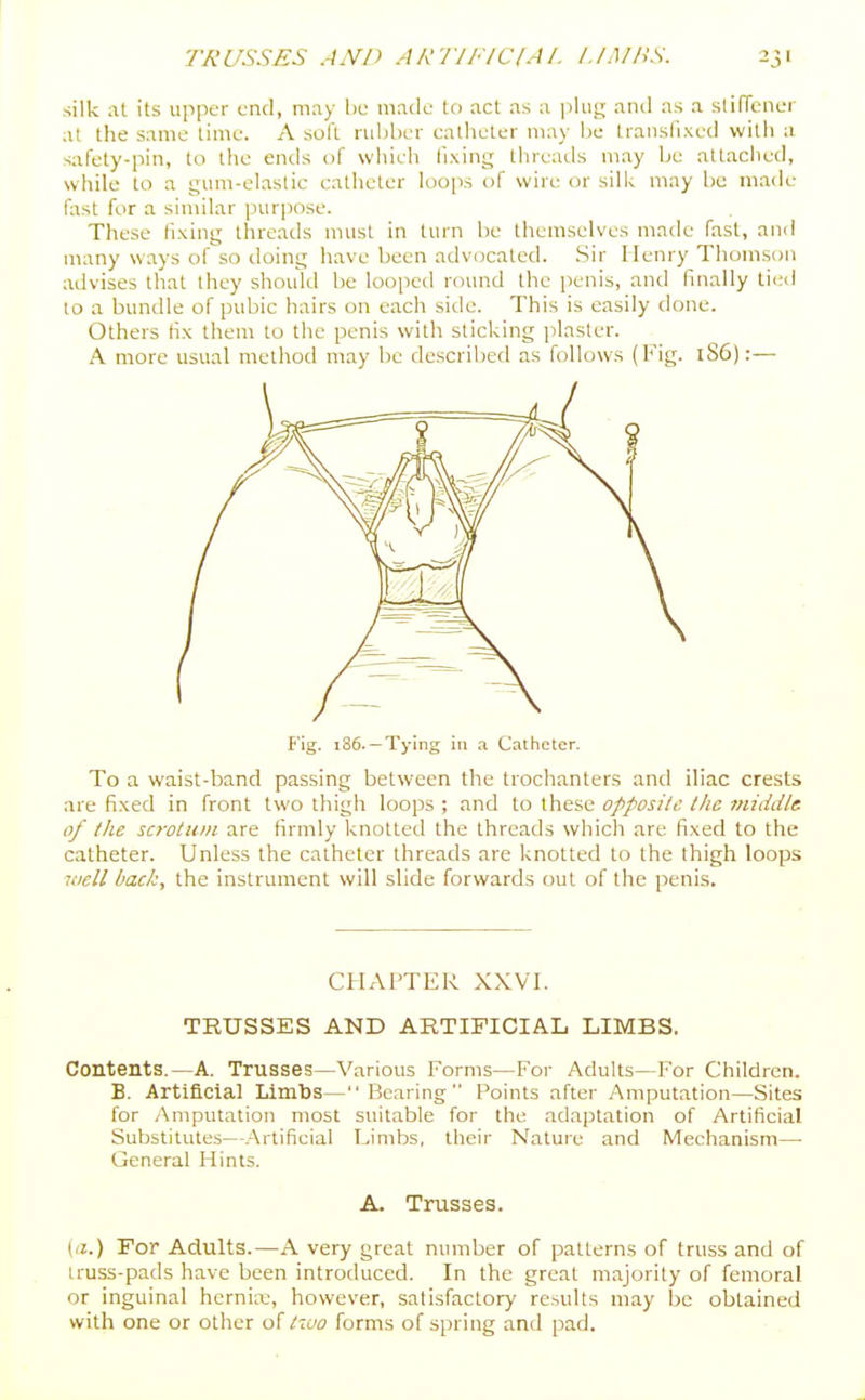silk at its upper end, may be made to act as a pkif^ and as a stiTfener at the same lime. A soft rubber catheter may be transfixed with a safety-pin, to the ends of wiiich fixing threads may be attached, while to a gum-elaslic catheter loo|w of wire or silk may be made f;ist for a similar purpose. These fixing threads must in turn be themselves made fast, and many ways of so doing have been advocated. Sir Henry Thomson advises that they should be looped round the penis, and finally tit^d to a bundle of pubic hairs on each side. This is easily done. Others fix them to the penis with sticking jilasler. A more usual method may be descriiied as follows (Fig. lS6):— F'ig. 186. —Tying in a Catheter. To a waist-band passing between the trochanters and iliac crests are fixed in front two thigh loops ; and to these opposilc the middle of the scrotum are firmly knotted the threads which are fixed to the catheter. Unless the catheter threads are knotted to the thigh loops well back, the instrument will slide forwards out of the penis. CHAPTER XXVT. TRUSSES AND ARTIFICIAL LIMBS. Contents.—A. Trusses—Various Forms—For Adults—For Children. B. Artificial Limbs— Bearing Points after Amputation—Sites for Amputation most suitable for the adaptation of Artificial Substitutes—Artificial Limbs, their Nature and Mechanism—■ General Hints. A. Trusses. (a.) For Adults.—A very great number of patterns of truss and of truss-pads have been introduced. In the great majority of femoral or inguinal hernia:, however, satisfactory results may be obtained with one or other of liuo forms of spring and pad.