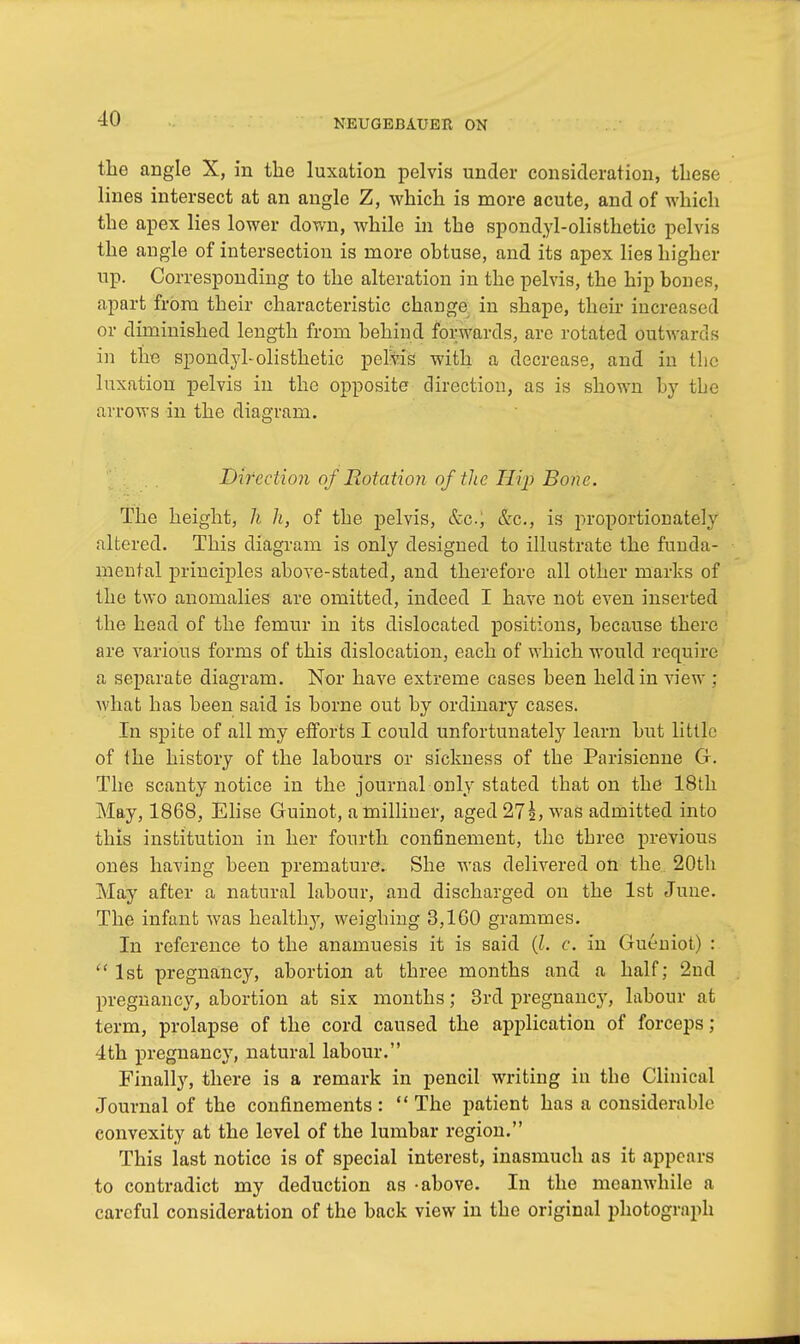the angle X, in the luxation pelvis under consideration, these lines intersect at an angle Z, which is more acute, and of which the apex lies lower down, while in the spondylolisthetic pelvis the angle of intersection is more obtuse, and its apex lies higher up. Corresponding to the alteration in the pelvis, the hip bones, apart from their characteristic change in shape, their increased or diminished length from behind forwards, are rotated outwards in the spondylolisthetic pelvis with a decrease, and in Hie luxation pelvis in the opposite direction, as is shown by tbe arrows in the diagram. Direction of Rotation of the Hip Bone. The height, h h, of the pelvis, &c) &c, is proportionately altered. This diagram is only designed to illustrate the funda- mental principles above-stated, and therefore all other marks of the two anomalies are omitted, indeed I have not even inserted the head of the femur in its dislocated positions, because there are Ararious forms of this dislocation, each of which would require a separate diagram. Nor have extreme cases been held in view : what has been said is borne out by ordinary cases. In spite of all my efforts I could unfortunately learn but little of the history of the labours or sickness of tbe Parisienne Or. The scanty notice in the journal only stated that on the 18th May, 1868, Elise Guinot, a milliner, aged 27L was admitted into this institution in her fourth confinement, the three previous ones having been premature. She was delivered on the 20th May after a natural labour, and discharged on the 1st June. The infant was healthy, weighing 3,100 grammes. In reference to the anamuesis it is said (I. c. in Gueniot) : 1st pregnancy, abortion at three months and a half; 2nd pregnancy, abortion at six months; 3rd pregnancy, labour at term, prolapse of the cord caused the application of forceps; 4th pregnancy, natural labour. Finally, there is a remark in pencil writing in tbe Clinical Journal of the confinements: The patient has a considerable convexity at the level of the lumbar region. This last notice is of special interest, inasmuch as it appears to contradict my deduction as -above. In the meanwhile a careful consideration of the back view in the original photograph