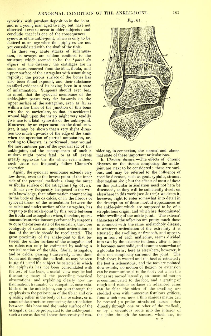 synovitis, with purulent deposition in tlie joint, and in a young man aged twenty, but have not observed it ever to occur in older subjects ; and conclude that it is one of the consequences synovitis of the ankle-joint, which is only to be noticed at an age when the epiphyses are not yet consolidated with the shaft of the tibia. In these very acute attacks of inflamma- tion, its ravages are seldom confined to the stracture which seemed to be the 'point du depart' of the disease; the cartilages are in some cases removed from the tibia, fibula, and upper surface of the astragalus with astonishing rapidity; the porous surface of the bones has also been found exposed, and their substance to afford evidence of its having been in a state of inflammation. Surgeons should ever bear in mind, that the synovial membrane of the ankle-joint passes very far forwards on the upper surface of the astragalus, even as far as within a few lines of the junction of this bone with the OS naviculare, so that an accidental wound high upon the mstep might very readily give rise to a fatal synovitis of the ankle-joint. Moreover, by an experiment on the dead sub- ject, it may be shown that a very slight direc- tion too much upwards of the edge of the knife when the operation of partial amputation, ac- cording to Chopart, is performed, may wound the most anterior part of the synovial sac of the ankle-joint, and the consequences of such a mishap might prove fatal, or at all events greatly aggravate the ills which even without such cause too frequently follow Chopart's operation. Again, the synovial membrane extends very low down, even to the lowest point of the inner side of the peroneal malleolus, along the outer or fibular surface of the astragalus { Jig- 61, u). It has very frequently happened to the wri- ter's knowledge, that inflammation commencing in the body of the os calcis, or in the fibrous or synovial tissue of the articulation between the OS calcis and under surface of the astragalus, has crept up to the ankle-joint by this route between the fibula and astragalus; when, therefore, opera- tionsand cauterizations are performed by surgeons to cure the carious state of the os calcis, the close contiguity of such an important articulation as that of the ankle should be recollected. The great proximity of the ankle-joint to that be- tween the under surface of the astragalus and OS calcis can only be estimated by making a vertical section of the tibia, fibula, astragalus, and OS calcis, passing transversely across these bones and through the malleoli, as may be seen in fig. 61 ; and if a subject be selected in which the epiphysis has not been consolidated with the rest of the bone, a useful view may be had illustrating many of the preceding practical observations, and explaining clearly how in- flammation, traumatic or idiopathic, once esta- blished in the ankle-joint, can pass through the epiphysis to the periosteum of the tibia; and ori- gmating either in the body of the os calcis, or in some of the structures composing the articulation between this bone and the under surface of the astragalus, can be propagated to the ankle-joint: such a viewas this will shew the necessity of con- Fig. 61. sideling, in connexion, the normal and abnor- mal state of these important articulations. b. Chronic disease.—The effects of chronic diseases on the tissues composing the ankle- joint are next to be considered ; these are vari- ous, and may be referred to the influence of specific diseases, such as gout, syphilis, struma, rheumatism, &c.; but the effects of most of these on this particular articulation need not here be discussed, as they will be sufficiently dwelt on elsewhere in this work (see Joint) : we deem it, however, right to enter somewhat into detail in the description of those morbid appearances of the ankle-joint which are supposed to be of a scrophulous origin, and which are denominated white swelling of the ankle-joint. The external characters of the affection are pretty much those in common with the same melancholy disease, in whatever articulation of the extremity it is situated; the swelling, at first soft, and appear- ing in front of each malleolus, seems divided into two by the extensor tendons; after a time it becomes more solid, and assumes somewhat of a globular form ; here as elsewhere, however, it does not completely surround the joint. The limb above is wasted and the heel is retracted ; the foot is cedematous, and the toes are pointed downwards, no motion of flexion or extension can be communicated to the foot; but when the bones are moved laterally, an unnatural motion is communicated to the foot, and a grating of rough and carious surfaces in advanced cases can be felt: the sides of the swelling are studded over with numerous fistulous orifices, from which even now a thin sanious matter can be pressed ; a probe introduced passes either directly through one or other of the malleoli, or by a circuitous route into the inferior of the joint through the sinuses, which are, as