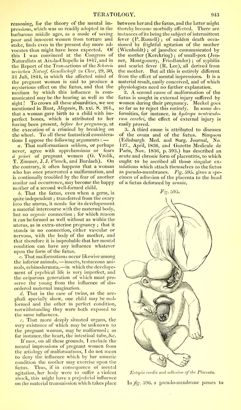 reasoning, for the theory of the mental im- pressions, which was so readily adopted in the barbarous middle ages, as a mode of saving poor and innocent women from torture and stake, finds even in the present day more ad- vocates than might have been expected. Of this I was convinced at the Congress of Naturalists at Aix-la-Chapelle in 1847, and in the Report of the Transactions of the Sckwei- zerischen Naturf. Gesellschaft zu Chur, 29, 30, 31 Juli, 1844, in which the affected mind of the pregnant woman is said to produce a mysterious effect on the foetus, and that the medium by which this influence is com- municated may be the hearing as well as the sight! To crown all these absurdities, we see mentioned in Rust, Magasin, B. xxi. S. 201., that a woman gave birth to a child with im- perfect bones, which is attributed to her having been present, before her pregnancy, at the execution of a criminal by breaking on the wheel. To all these fantastical considera- tions I oppose the following arguments : — a. That malformations seldom, or perhaps never, agree with apprehensions or fears d priori of pregnant women (G. Vrolik, T. Zimmer, J.J. Flenck, and Burdach). On the contrary, it often happens that a woman who has once procreated a malformation, and is continually troubled by the fear of another similar sad occurrence, may become the happy mother of a second well-formed child. b. That the foetus, even when a germ, is quite independent; transferred from the ovary into the uterus, it needs for its developcment a material intercourse with the maternal body, but no organic connection ; for which reason it can be formed as well without as within the uterus, as in extra-uterine pregnancy ; that it stands in no connection, either vascular or nervous, with the body of the mother, and that therefore it is improbable that her mental condition can have any influence whatever upon the form of the foetus. c. That malformations occur likewise among the inferior animals, — insects, testaceous ani- mals, echinodermata,—in which the developer ment of psychical life is very imperfect, and the oviparous generation of which must pre- serve the young from the influence of dis- ordered maternal imagination. cl. That in the case of twins, as the ace- phali specially show, one child may be mal- formed and the other in perfect condition, notwithstanding they were both exposed to the same influences. e. That more deeply situated organs, the very existence of which may be unknown to the pregnant woman, may be malformed ; as for instance, the heart, the intestinal tube, &c. If now, on all these grounds, I exclude the mental impressions of pregnant women from the aetiology of malformations, I do not mean to deny the influence which by her somatic condition the mother may exercise upon the foetus. Thus, if in consequence of mental agitation, her body were to suffer a violent shock, this might have a prejudicial influence on the material transmission which takes place between her and the foetus, and the latter might thereby become morbidly affected. There are instances ofits being the subject of intermittent fever (P. Russell) ; of sudden death occa- sioned by frightful agitation of the mother (Wienholdt) ; of jaundice communicated by the mother (Kerckring) ; of small-pox (Jen- ner, Montgomery, Friedlander) ; of syphilis and scarlet fever (R. Lee), all derived from the mother. But all this is entirely different from the effect of mental impressions. It is a material result, easily conceived, and of which physiologists need no further explanation. 2. A second cause of malformation of the foetus is sought in external injury suffered by women during their pregnancy. Meckel goes so far as to reject this entirely. In some de- formities, for instance, in hydrops ventriculo- rum cerebri, the effect of external injury is easily proved. 3. A third cause is attributed to diseases of the ovurn and of the foetus. Simpson (Edinburgh Med. and Surg. Journal, No. 127., April, 1836, and Gazette Medicale de Paris, Nov. 183G, p. 393.) has described an acute and chronic form of placentitis, to which ought to be ascribed all those singular ex- udations which attach themselves to the foetus as pseudo-membranes. Fig. 595. gives a spe- cimen of adhesion of the placenta to the head of a foetus deformed by urania. Fig. 595. Ectopia cordis and adliesion of the Placenta. In fig. 59G. a pseudo-membrane passes to