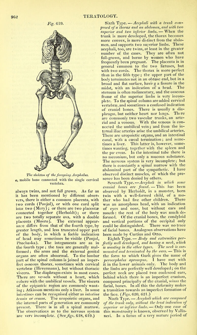 Fig. 619. The skeleton of the foregoing Acephalus. a, mobile bone connected with the single cervical vertebra. always twins, and not full grown. As far as it has been mentioned by different obser- vers, there is either a common placenta, with two cords (Ponjol), or with one cord split into two (Mery) ; or there are two placentae connected together (Herholdt); or there are two totally separate ova, with a double placenta (Monro). The external appear- ance differs from that of the fourth type, by greater length, and less truncated upper part of the body, in which a feeble indication of head may sometimes be visible (Ponjol, I'rocliaska). The integuments are as in the fourth type ; the toes are generally mal- formed ; the arms and the external genital organs are often abnormal. To the lumbar part of the spinal column is joined an imper- fect osseous thorax, sometimes with cervical vertebrae (Hevermann), but without thoracic viscera. The diaphragm exists in most cases. There are vessels without a heart, which cohere with the umbilical vessels. The viscera of the epigastric region are commonly want- ing ; Atkinson mentions only a liver. In some intestines can be recognised either as inteslina tenuia or crassa. The uropoietic organs, and the internal parts of generation are commonly present. There is in all a spinal marrow. The observations as to the nervous system are verv incomplete. (SeeJigs. 618, 619.) Sixth Type. — Acephali ivith a Irunlc com- posed of a thorax and an abdomen, and ivith two superior and two inferior limbs. — When the trunk is more developed, the thorax becomes more convex, is more distinct from the abdo- men, and supports two superior limbs. These acephali, too, are twins, at least in the greater number of the cases. They are often not full-grown, and borne by women who have frequently been pregnant. The placenta is in general common to the two foetuses, but with two cords. The thorax is more perfect than in the fifth type; the upper part of the bodv terminates not in an obtuse end, but in a broad and flat surface, havir g a fissure in the midst, with an indication of a head. The sternum is often rudimentary, and the osseous frame of the superior limbs is very incom- plete. To the spinal column are added cervical vertebrae, and sometimes a confused indication of cranial bones. There is usually a dia- phragm, but neither heart nor lungs. There are commonly two vascular trunks, an arte- rial and a venous. With the venous is con- nected the umbilical vein ; and from the in- ternal iliac arteries arise the umbilical arteries. There are uropoietic organs, and an intestinal canal, with a caecal termination ; and some- times a liver. This latter is, however, some- times wanting, together with the spleen and the par creas. In the intestinal tube there is no meconium, but only a mucous substance. The nervous system is very incomplete; but there is constantly a spinal marrow with the abdominal part of the sympathetic. I have observed distinct muscles, of which the pre- sence has been denied by others. Seventh Type.—Acephali in which some cranial bones are found. — This has been observed by Herholdt, in a monster, born twin with a well-formed child, of a mo- ther who had five other children. There was an amorphous head, with an indication of eyes and nose, but without ears and mouth : the rest of the body was much de- formed. Of the cranial bones, the condyloid and vertical portions of the occipital only could be distinguished. There was no trace of facial bones. Analogous observations have been made by Curtius and Otto. Eighth Type. — Body and extremities per- fectly well developed, and having a neck, which is wanting in the other types. The neck is sur- mounted and terminated by the ears. — This is the form to which Gurlt gives the name of perocephalus aprosopus. I have met with it in the lower animals only. The body and the limbs are perfectly well developed ; on the perfect neck are placed two coalesced ears, behind which there is an imperfect cranium, composed principally of the cranial, minus the facial, bones. In all this the deformity makes a transition towards an imperfect formation of the face. (Figs. 620, 621.) Ninth Type. — Acephali which are composed of the trunk only, without the least indication of superior or inferior limbs. — Only one case of this monstrosity is known, observed by Vallis- neri. In a foetus of a very mature period of