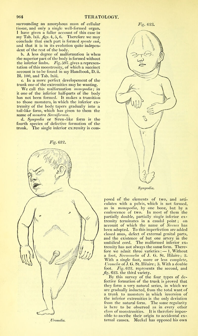 surrounding an amorphous mass of cellular tissue, and only a single well-formed organ. I have given a fuller account of this case in my Tab. Ixii. Jigs. 4, 5, 6. Therefore we may conclude that each part is formed sponte sua, and that it is in its evolution quite indepen- dent of the rest of the body. b. A Jess degree of malformation is when the superior part of the body is formed without the inferior limbs. Fig. 597. gives a represen- tation of this monstrosity, of which a succinct account is to be found in my Handbook, D. ii. Bl. 100, and Tab. Ixiii. c. In a more perfect developement of the trunk one of the extremities may be wanting. We call this malformation monopodia; in it one of the inferior half-parts of the body has not been formed. It makes a transition to those monsters, in which the inferior ex- tremity of the body tapers gradually into a tail-like form, which has given to them the name of monstra Sireniformia. d. Sympodia or Siren-like form is the fourth species of defective formation of the trunk. The single inferior extremity is com- Fig. 622. Fig. 623. Sympodu posed of the elements of two, and arti- culates with a pelvis, which is not formed, as in monopodia, by one bone, but by a coalescence of two. In most of them the partially double, partially single inferior ex- tremity terminates in a caudal point ; on account of which the name of Sirenes has been adopted. To this imperfection are added closed anus, defect of external genital parts, and the existence of but one artery in the umbilical cord. The malformed inferior ex- tremity has not always the same form. There- fore we admit three varieties:—1. Without a foot, Sirenomielia of J. G. St. Hilaire; 2. With a single foot, more or less complete, Uromelia of J. G. St. Hilaire; 3. With a double foot. Fig. 622. represents the second, and Jig. 623. the third variety. By this survey of the four types of de- fective formation of the trunk is proved that they form a very natural series, in which we are gradually inducted, from the total want of a trunk to monsters in which inversion of the inferior extremities is the only deviation from the natural form. The same regularity is here to be observed as in every other class of monstrosities. It is therefore impos- sible to ascribe their origin to accidental ex- ternal causes. Meckel has opposed his own