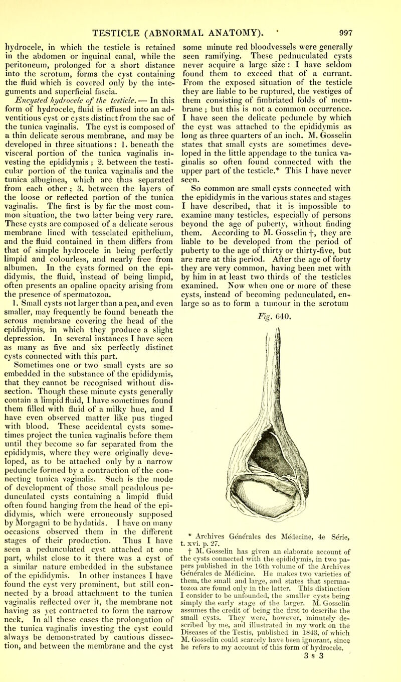 hydrocele, in which the testicle is retained in the abdomen or inguinal canal, while the peritoneum, prolonged for a short distance into the scrotum, forms the cyst containing the fluid which is covered only by the inte- guments and superficial fascia. Encysted hydrocele of the testicle.— In this form of hydrocele, fluid is effused into an ad- ventitious cyst or cysts distinct from the sac of the tunica vaginalis. The cyst is composed of a thin delicate serous membrane, and may be developed in three situations: I, beneath the visceral portion of the tunica vaginalis in- vesting the epididymis ; 2. between the testi- cular portion of the tunica vaginalis and the tunica albuginea, which are thus separated from each other ; 3. between the layers of the loose or reflected portion of the tunica vaginalis. The first is by far the most com- mon situation, the two latter being very rare. These Cj'sts are composed of a delicate serous membrane lined with tesselated epithelium, and the fluid contained in them differs from that of simple hydrocele in being perfectly limpid and colourless, and nearly free from albumen. In the cysts formed on the epi- didymis, the fluid, instead of being limpid, often presents an opaline opacity arising from the presence of spermatozoa. 1. Small cysts not larger than a pea, and even smaller, may frequently be found beneath the serous membrane covering the head of the epididymis, in which they produce a slight depression. In several instances I have seen as many as five and six perfectly distinct cysts connected with this part. Sometimes one or two small cysts are so embedded in the substance of the epididymis, that they cannot be recognised without dis- section. Though these minute cysts generally contain a limpid fluid, I have sometimes found them filled with fluid of a milky hue, and I have even observed matter like pus tinged with blood. These accidental cysts some- times project the tunica vaginalis before them until they become so far separated from the epididymis, where they were originally deve- loped, as to be attached only by a narrow peduncle formed by a contraction of the con- necting tunica vaginalis. Such is the mode of development of those small pendulous pe- dunculated cysts containing a limpid fluid often found hanging from the head of the epi- didymis, which were erroneously supposed by Morgagni to be hydatids. I have on many occasions observed them in the different stages of their production. Thus I have seen a pedunculated cyst attached at one part, whilst close to it there was a cyst of a similar nature embedded in the substance of the epididymis. In other instances I have found the cyst very prominent, but still con- nected by a broad attachment to the tunica vaginalis reflected over it, the membrane not having as yet contracted to form the narrow neck. In all these cases the prolongation of the tunica vaginalis investing the cyst could always be demonstrated by cautious dissec- tion, and between the membrane and the cyst some minute red bloodvessels were generally seen ramifying. These pednuculated cysts never acquire a large size : I have seldom found them to exceed that of a currant. From the exposed situation of the testicle they are liable to be ruptured, the vestiges of them consisting of fimbriated folds of mem- brane ; but this is not a common occurrence. I have seen the delicate peduncle by which the cyst was attached to the epididymis as long as three quarters of an inch. M. Gosselin states that small cysts are sometimes deve- loped in the little appendage to the tunica va- ginalis so often found connected with the upper part of the testicle.* This I have never seen. So common are small cysts connected with the epididymis in the various states and stages I have described, that it is impossible to examine many testicles, especially of persons beyond the age of puberty, without finding them. According to M. Gosselin f, they are liable to be developed from the period of puberty to the age of thirty or thirty-five, but are rare at this period. After the age of forty they are very common, having been met with by him in at least two thirds of the testicles examined. Now when one or more of these cysts, instead of becoming pedunculated, en- large so as to form a tumour in the scrotum * Archives Ge'nerales des Mexlecine, 4e Se'rie, t. xvi. p. 27. f M. Gosselin has given an elaborate account of the cysts connected with the epididymis, in two pa- pers published in the 16th volume of the Archives Ge'nerales de Medicine. He makes two varieties of them, the small and large, and states that sperma- tozoa are found only in the latter. This distinction I consider to be unfounded, the smaller cysts being simply the early stage of the larger. M. Gosselin assumes the credit of being the first to describe the small cysts. They were, however, minutely de- scribed by me, and illustrated in my work on the Diseases of the Testis, published in 18-A3, of which M. Gosselin could scarcely have been ignorant, since he refers to my account of this form of hydrocele. 3 s3