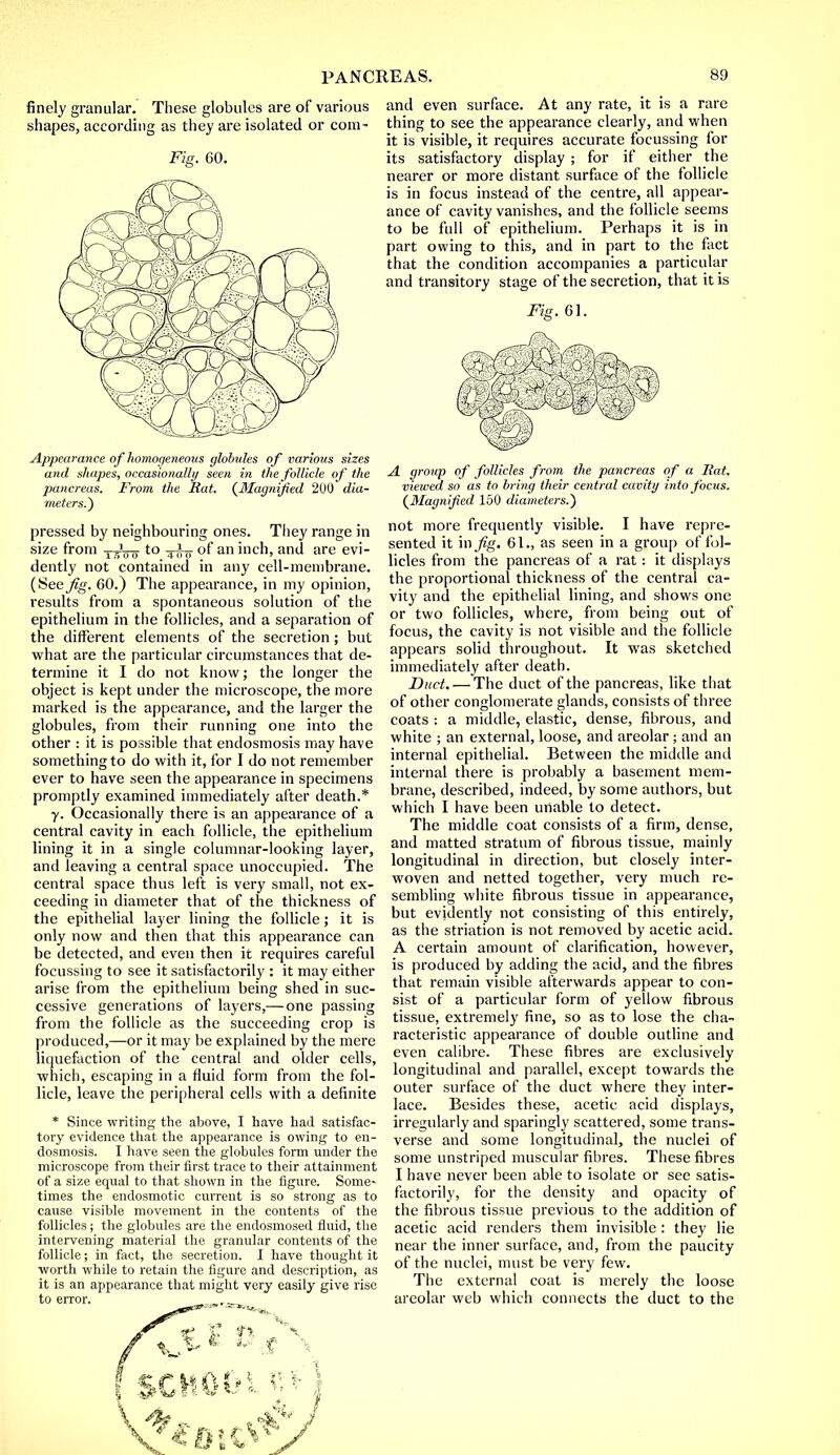 finely granular. These globules are of various shapes, according as they are isolated or com- Fig. 60. Appearance of homogeneotts globules of various sizes and shapes, occasionally seen in the follicle of the pancreas. From the Rat. (Magnified 200 dia- meters.) pressed by neighbouring ones. They range in size from t *0 0 to of an inch, and are evi- dently not contained in any cell-membrane. (Seej£g. 60.) The appearance, in my opinion, results from a spontaneous solution of the epithelium in the follicles, and a separation of the different elements of the secretion; but what are the particular circumstances that de- termine it I do not know; the longer the object is kept under the microscope, the more marked is the appearance, and the larger the globules, from their running one into the other : it is possible that endosmosis may have something to do with it, for I do not remember ever to have seen the appearance in specimens promptly examined immediately after death.* y. Occasionally there is an appearance of a central cavity in each follicle, the epithelium lining it in a single columnar-looking layer, and leaving a central space unoccupied. The central space thus left is very small, not ex- ceeding in diameter that of the thickness of the epithelial layer lining the follicle; it is only now and then that this appearance can be detected, and even then it requires careful focussing to see it satisfactorily : it may either arise from the epithelium being shed in suc- cessive generations of layers,— one passing from the follicle as the succeeding crop is produced,—or it may be explained by the mere liquefaction of the central and older cells, which, escaping in a fluid form from the fol- licle, leave the peripheral cells with a definite * Since writing the above, I have had satisfac- tory evidence that the appearance is owing to en- dosmosis. I have seen the globules form under the microscope from their first trace to their attainment of a size equal to that shown in the figure. Some* times the endosmotic current is so strong as to cause visible movement in the contents of the follicles; the globules are the endosmosed fluid, the intervening material the granular contents of the follicle; in fact, the secretion. I have thought it worth while to retain the figure and description, as it is an appearance that might very easily give rise to error. * I SCHOOL R*j \ 4? * . . ^ J and even surface. At any rate, it is a rare thing to see the appearance clearly, and when it is visible, it requires accurate focussing for its satisfactory display ; for if either the nearer or more distant surface of the follicle is in focus instead of the centre, all appear- ance of cavity vanishes, and the follicle seems to be full of epithelium. Perhaps it is in part owing to this, and in part to the fact that the condition accompanies a particular and transitory stage of the secretion, that it is Fig. 61. A group of follicles from the pancreas of a Rat, viewed so as to bring their central cavity into focus. (Magnified 150 diameters.) not more frequently visible. I have repre- sented it in 61., as seen in a group of fol- licles from the pancreas of a rat: it displays the proportional thickness of the central ca- vity and the epithelial lining, and shows one or two follicles, where, from being out of focus, the cavity is not visible and the follicle appears solid throughout. It was sketched immediately after death. Duct. — The duct of the pancreas, like that of other conglomerate glands, consists of three coats : a middle, elastic, dense, fibrous, and white ; an external, loose, and areolar ; and an internal epithelial. Between the middle and internal there is probably a basement mem- brane, described, indeed, by some authors, but which I have been unable to detect. The middle coat consists of a firm, dense, and matted stratum of fibrous tissue, mainly longitudinal in direction, but closely inter- woven and netted together, very much re- sembling white fibrous tissue in appearance, but evidently not consisting of this entirely, as the striation is not removed by acetic acid. A certain amount of clarification, however, is produced by adding the acid, and the fibres that remain visible afterwards appear to con- sist of a particular form of yellow fibrous tissue, extremely fine, so as to lose the cha- racteristic appearance of double outline and even calibre. These fibres are exclusively longitudinal and parallel, except towards the outer surface of the duct where they inter- lace. Besides these, acetic acid displays, irregularly and sparingly scattered, some trans- verse and some longitudinal, the nuclei of some unstriped muscular fibres. These fibres I have never been able to isolate or see satis- factorily, for the density and opacity of the fibrous tissue previous to the addition of acetic acid renders them invisible : they lie near the inner surface, and, from the paucity of the nuclei, must be very few. The external coat is merely the loose areolar web which connects the duct to the