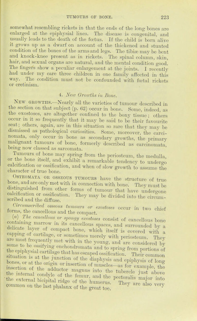 somewhat resembling rickets in that the ends of the long bones are enlarged at the epiphysial lines. The disease is congenital, and usually leads to the death of the foetus. If the child is born alive it grows up as a dwarf on account of the thickened and stunted condition of the bones of the arms and legs. The tibiee may be bent and knock-knee present as in rickets. The spinal column, skin, hair, and sexual organs are natural, and the mental condition good. The fingers show a peculiar enlargement at the joints. I recently had under my care three children in one family affected in this way. The condition must not be confounded with foetal rickets or cretinism. 4. New Growths in Bone. New growths.—Nearly all the varieties of tumour described in the section on that subject (p. 62) occur in bone. Some, indeed, as the exostoses, are altogether confined to the bony tissue; others occur m it so frequently that it may be said to be their favourite seat; others, again, are in this situation so rare that they max- be dismissed as pathological curiosities. Some, moreover the carci- nomata, only occur in bone as secondary growths, the primary malignant tumours of bone, formerly described as carcinomata being now classed as sarcomata. Tumours of bone may spring from the periosteum, the medulla or the bone itself, and exhibit a remarkable tendency to under.,', calcification or ossification, and when of slow growth to assume the character of true bono. Osteomata or osseous tumours have the structure of true bone, and are only met with in connection with hone. They must he distinguished from other forms of tumour that have undergone Sdt^e011' ^-^e divided into the ch.cL. Circumscribed osseous tumours or exostoses occur in two chief forms, the cancellous and the compact. (a) The cancellous or sponc/y exostoses consist of cancellous bone contammg marrow m its cancellous spaces, and surrounded by a dehcate layer of compact hone, which itself is covered with capping of callage, or sometimes merely with periosteum. They nost in,1u,ntly met with in the young, and are considered by some to be ossifying enchondromata and to spring from portions of he epxphysxal cartilage that has escaped ossificatiom S coZon Mtuation is at the junction of the diaphysis and epiphvs s f W bones, or at the origin or insertion of museles-as ffeSe 2 ^external bicipital ridge , Z'h ■ £ t^T ?*° ***** « the last phalanx of the great toe. ' ^