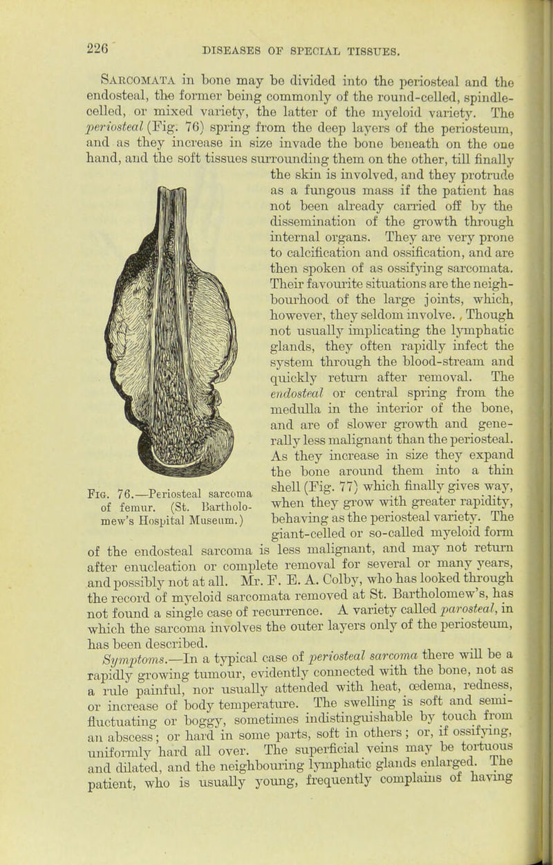 22G Sarcomata in bone may bo divided into the periosteal and the endosteal, the former being commonly of the round-celled, spindle- celled, or mixed variety, the latter of the myeloid variety. The periosteal (Fig; 76) spring from the deep layers of the periosteum. and as they increase in size invade the bone beneath on the one hand, and the soft tissues surrounding them on the other, till finally the skin is involved, and they protrude as a fungous mass if the patient has not been already carried off by the dissemination of the growth through internal organs. They are very prone to calcification and ossification, and are then spoken of as ossifying sarcomata. Their favourite situations are the neigh- bourhood of the large joints, which, however, they seldom involve., Though not usually implicating the lymphatic glands, they often rapidly infect the system through the blood-stream and quickly return after removal. The endosteal or central spring from the medulla in the interior of the bone, and are of slower growth and gene- rally less malignant than the periosteal. As they increase in size they expand the bone around them into a thin Fig. 76._Periosteal sarcoma Cg* which finally gives way, of femur. (St. Bartholo- when they giw with greater rapidity, mew's Hospital Museum.) behaving as the periosteal variety. The giant-celled or so-called myeloid form of the endosteal sarcoma is less malignant, and may not return after enucleation or complete removal for several or many years, and possibly not at all. Mr. F. E. A. Colby, who has looked through the record of myeloid sarcomata removed at St. Bartholomew's, has not found a single case of recurrence. A variety called parosteal, in which the sarcoma involves the outer layers only of the periosteum, has been described. Symptoms .—In a typical case of periosteal sarcoma there will be a rapidly growing tumour, evidently connected with the bone, not as a rule painful, nor usually attended with heat, oedema, redness, or increase of body temperature. The swelling is soft and semi- fluctuating or boggy, sometimes indistinguishable by touch from an abscess; or hard in some parts, soft in others; or, if ossifying, uniformly hard all over. The superficial veins may be tortuous and dilated, and the neighbouring lymphatic glands enlarged Ine patient, who is usually young, frequently complains of having