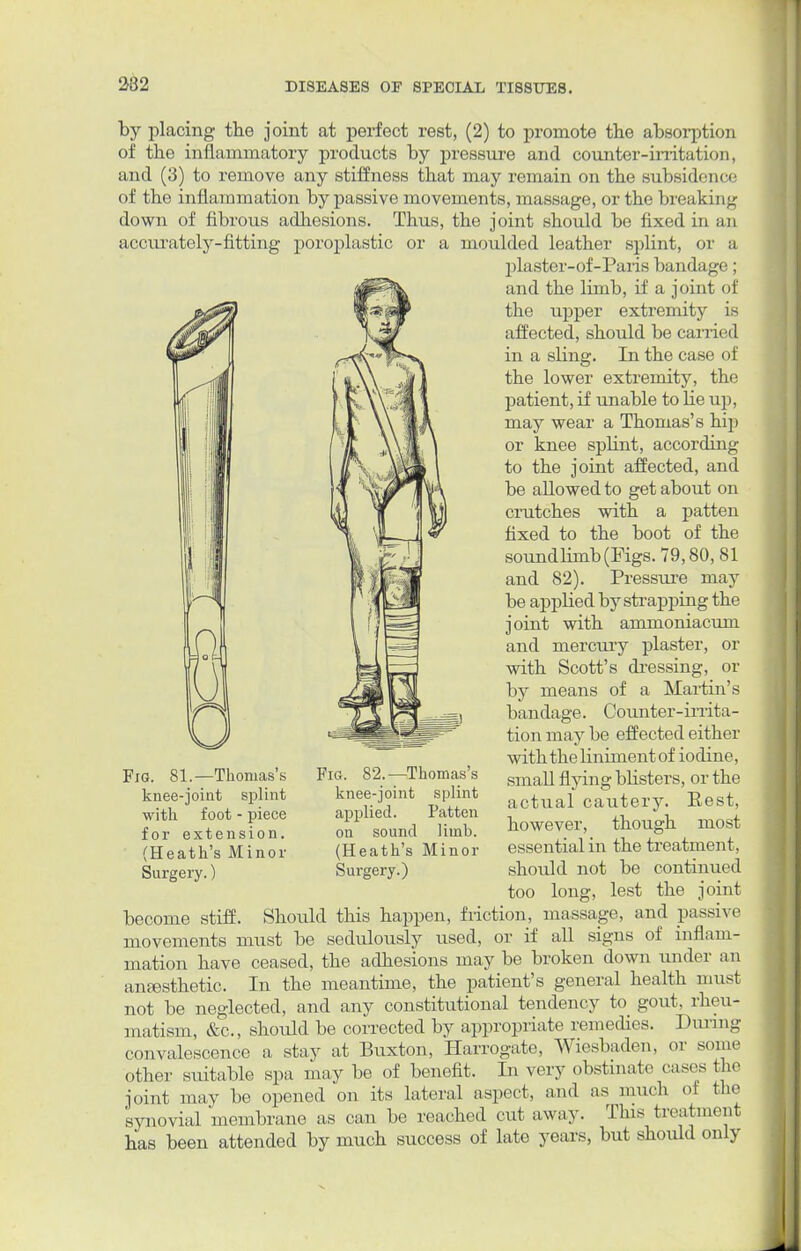 by placing the joint at perfect rest, (2) to promote the absorption of the inflammatory products by pressure and counter-irritation, and (3) to remove any stiffness that may remain on the subsidence of the inflammation by passive movements, massage, or the breaking down of fibrous adhesions. Thus, the joint should be fixed in an accurately-fitting poroplastic or a moulded leather splint, or a plaster-of-Paris bandage; and the limb, if a joint of the upper extremity is affected, should be carried in a sling. In the case of the lower extremity, the patient, if unable to He up, may wear a Thomas's hip or knee splint, according to the joint affected, and be allowed to get about on crutches with a patten fixed to the boot of the soundlimb(Figs. 79,80, 81 and 82). Pressure may be applied by strapping the joint with ammoniacum and mercury plaster, or with Scott's dressing, or by means of a Martin's bandage. Counter-irrita- tion may be effected either with the liniment of iodine, small flying blisters, or the actual cautery. Kest, however, though most essential in the treatment , should not be continued too long, lest the joint become stiff. Should this happen, friction, massage, and passive movements must be sedulously used, or if all signs of inflam- mation have ceased, the adhesions may be broken down under an anesthetic. In the meantime, the patient's general health must not be neglected, and any constitutional tendency to gout, rheu- matism, &c, should be corrected by appropriate remedies. During convalescence a stay at Buxton, Harrogate, Wiesbaden, or Borne other suitable spa may be of benefit. In very obstinate cases the joint may be opened on its lateral aspect, and as much of the synovial membrane as can be reached cut away. This treatment has been attended by much success of late years, but should only Fig. 81.—Thomas's knee-joint splint with foot - piece for extension. (Heath's Minor Surgery.) FlG. 82.—Thomas's knee-joint splint applied. Patten on sound limb. (Heath's Minor Surgery.)