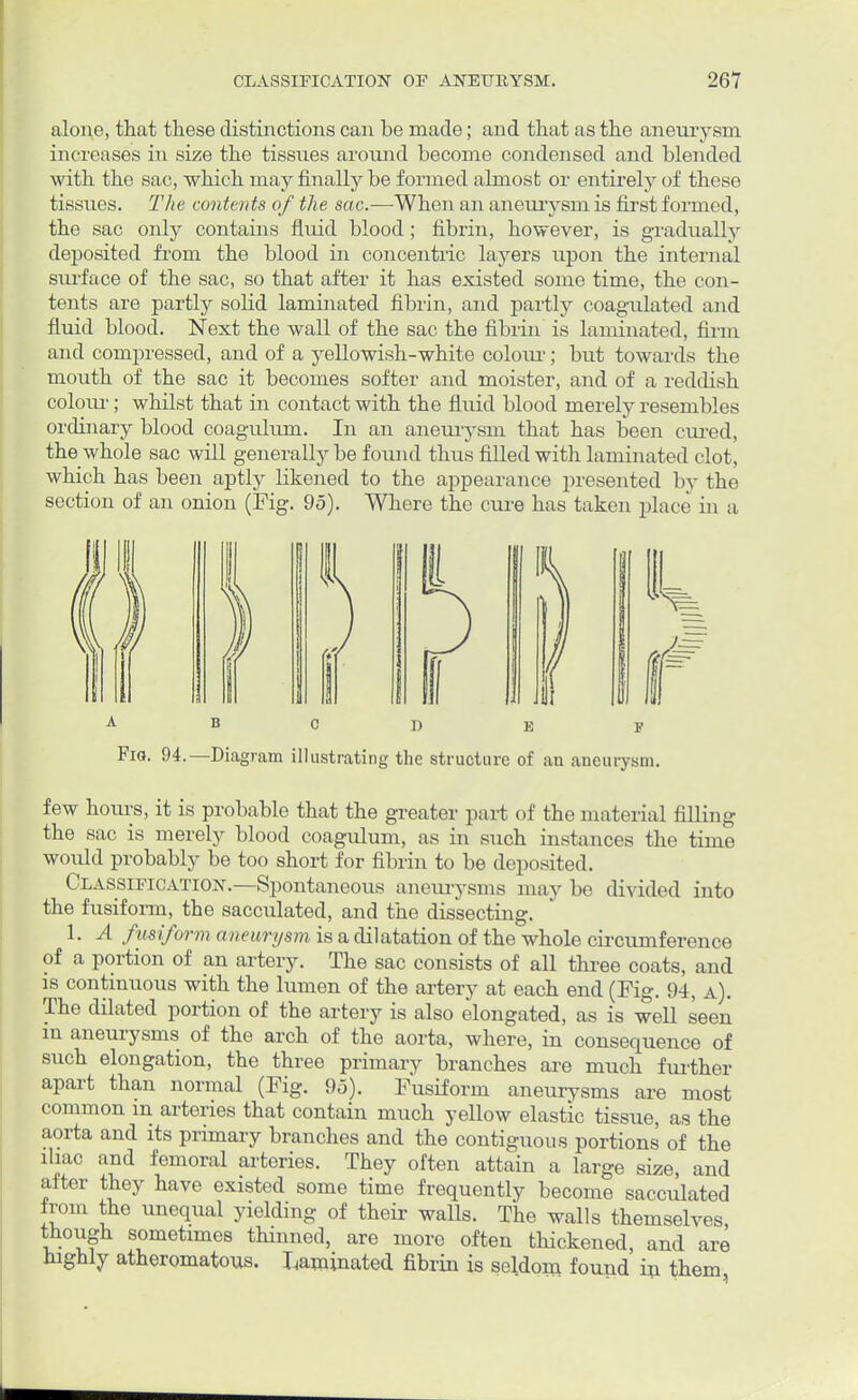 alone, that these distinctions can be made; and that as the aneurysm increases in size the tissues around become condensed and blended with the sac, which may finally be formed almost or entirely of these tissues. The contents of the sac.—When an aneurysm, is first formed, the sac only contains fluid blood; fibrin, however, is gradually deposited from the blood in concentric layers upon the internal surface of the sac, so that after it has existed some time, the con- tents are partly solid laminated fibrin, and partly coagulated and fluid blood. Next the wall of the sac the fibrin is laminated, firm and compressed, and of a yellowish-white colour; but towards the mouth of the sac it becomes softer and moister, and of a reddish colour; whilst that in contact with the fluid blood merely resembles ordinary blood coagulum. In an aneurysm that has been cured, the whole sac will generally be found thus filled with laminated clot, which has been aptly likened to the appearance presented by the section of an onion (Fig. 95). Where the cure has taken place in a Fig. 94.—Diagram illustrating the structure of an aneurysm. few hours, it is probable that the greater part of the material filling the sac is merely blood coagulum, as in such instances the time would probably be too short for fibrin to be deposited. Classification.—Spontaneous aneurysms may be divided into the fusiform, the sacculated, and the dissecting. 1. A fusiform aneurysm is a dilatation of the whole circumference of a portion of an artery. The sac consists of all three coats, and is continuous with the lumen of the artery at each end (Fig. 94, a). The dilated portion of the artery is also elongated, as is well seen in aneurysms of the arch of the aorta, where, in consequence of such elongation, the three primary branches are much further apart than normal (Fig. 95). Fusiform aneurysms are most common in arteries that contain much yellow elastic tissue, as the aorta and its primary branches and the contiguous portions of the iliac and femoral arteries. They often attain a large size, and after they have existed some time frequently become sacculated from the unequal yielding of their walls. The walls themselves, though sometimes thinned, are more often thickened, and are highly atheromatous. Laminated fibrin is seldom found in them