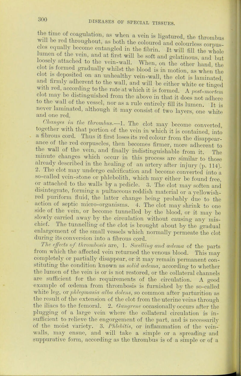aoo DISEASES OF 8I>ECIAE TISSUES. ketone of coagulation, as when a vein is ligatured, the thrombus will I- red throughout, as both the coloured and colourless cor™! cles equally become entangled in the fibrin. It will fill the who], ,;n th'; ™. ^ first will be soft and gelatinous, and bu loosely attached to the vein-wall. When, on the other Ud, the dot is formed gradually whilst the blood is in motion, as when the clot is deposited on an unhealthy vein-wall, the clot is laminated and firmly adherent to the wall, and will he cither white or tinned with red, according to the rate at which it is formed. A post-moHem clot may be distinguished from the above in that it does not adhere to the wall of the vessel, nor as a rule entirely fill its lumen It is never laminated, although it may consist of 'two layors, one white and one red. Changes in the thrombus.~\. The clot may become converted together with that portion of the vein in which it is contained, into a fibrous cord. Thus it first loses its red colour from the disappear- ance of the red corpuscles, then becomes firmer, more adherent to the waU of the vein, and finally indistinguishable from it. The minute changes which occur in this process are similar to those already described in the healing of an artery after injury (p. 114). 2. The clot may undergo calcification and become converted into a so-called vein-stone or phlebolith, which may either be found free, or attached to the walls by a pedicle. 3. The clot may soften and disintegrate, forming a pultaceous reddish material or a yellowish- red puriform fluid, the latter change being probably due to the action of septic micro-organisms. 4. The clot may shrink to one side of the rein, or become tunnelled by the blood, or it may be slowly carried away by the circulation without causing any mis- chief. The tunnelling of the clot is brought about by the gradual enlargement of the small vessels which normally permeate the clot during its conversion into a fibrous cord. The effects of thrombosis are, 1. Swelling «»<! o&dema of the parts from which the affected vein returned the venous blood. This may completely or partially disappear, or it may remain permanent con- stituting the condition known as solid oedema, according to whether the lumen of the vein is or is not restored, or the collateral channels are sufficient for the requirements of the circulation. A good example of oedema from thrombosis is furnished by the so-called white leg, or phlegmasia alba dolens, so common after* parturition as the result of the extension of the clot from the uterine veins through the iliacs to the femoral. 2. Gangrene occasionally occurs after the plugging of a large vein where the collateral circulation is in- sufficient to relieve the engorgement of the part, and is necessarily of the moist variety. 3. Phlebitis, or inflammation of the vein- walls, may ensue, and will take a simple or a spreading and suppurative form, according as the thrombus is of a simple or of a