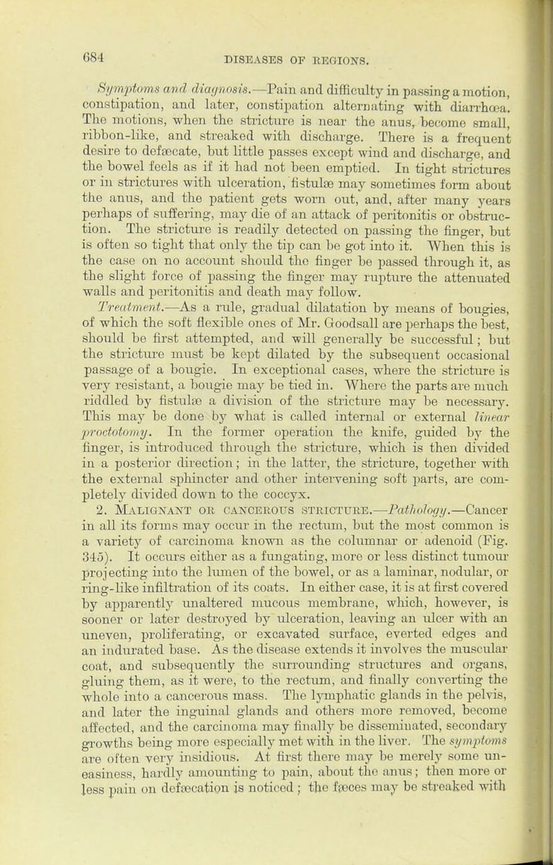 Symptoms and diagnosis.—Pain and difficulty in passing a motion, constipation, and later, constipation alternating with diarrhoea. The motions, when the stricture is near the anus, become small ribbon-like, and streaked with discharge. There is a frequent desire to defecate, but little passes except wind and discharge, and the bowel feels as if it had not been emptied. In tight strictures or in strictures with ulceration, fistufe may sometimes form about the anus, and the patient gets worn out, and, after many years perhaps of suffering, may die of an attack of peritonitis or obstruc- tion. The stricture is readily detected on passing the finger, but is often so tight that only the tip can be got into it. When this is the case on no account should the finger be passed through it, as the slight force of passing the finger may rupture the attenuated walls and peritonitis and death may follow. Treatment.—As a rule, gradual dilatation by means of bougies, of which the soft flexible ones of Mr. Goodsall are perhaps the best, should be first attempted, and will generally be successful; but the stricture must be kept dilated by the subsequent occasional passage of a bougie. In exceptional cases, where the stricture is very resistant, a bougie may be tied in. Where the parts are much riddled by fistulas a division of the stricture may be necessary. This may be done by what is called internal or external linear proctotomy. In the former operation the knife, guided by the finger, is introduced through the stricture, which is then divided in a posterior direction; in the latter, the stricture, together with the external sphincter and other intervening soft parts, are com- pletely divided down to the coccyx. 2. MALIGNANT or cancerous stricture.—Pathology.—Cancer in all its forms may occur in the rectum, but the most common is a variety of carcinoma known as the columnar or adenoid (Fig. 345). It occvu's either as a fungatiDg, more or less distinct tumour projecting into the lumen of the bowel, or as a laminar, nodular, or ring-like infiltration of its coats. In either case, it is at first covered by apparently unaltered mucous membrane, which, however, is sooner or later destroyed by ulceration, leaving an ulcer with an uneven, proliferating, or excavated surface, everted edges and an indurated base. As the disease extends it involves the muscular coat, and subsequently the surrounding structures and organs, gluing them, as it were, to the rectum, and finally converting the whole into a cancerous mass. The lymphatic glands in the pelvis, and later the inguinal glands and others more removed, become affected, and the carcinoma may finally be disseminated, secondary growths being more especially met with in the liver. The symptoms are often very insidious. At first there may be merely some un- easiness, hardly amounting to pain, about the anus; then more or less pain on defecation js noticed ; the feces may be streaked with