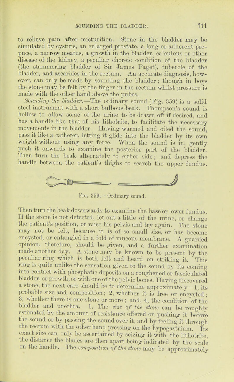 to relieve pain after micturition. Stone in the bladder may be simulated by cystitis, an enlarged prostate, a long or adherent pre- puce, a narrow meatus, a growth in the bladder, calculous or other disease of the kidney, a peculiar choreic condition of the bladder (the stammering bladder of Sir James Paget), tubercle of the bladder, and ascarides in the rectum. An accurate diagnosis, how- ever, can only be made by sounding the bladder ; though in boys the stone may be felt by the finger in the rectum whilst pressure is made with the other hand above the pubes. Sounding the bladder.—The ordinary sound (Fig. 359) is a solid steel instrument with a short bulbous beak. Thompson's sound is hollow to allow some of the urine to be drawn off if desired, and has a handle like that of his lithotrite, to facilitate the necessary movements in the bladder. Having warmed and oiled the sound, pass it like a catheter, letting it glide into the bladder by its own weight without using any force. When the sound is in, gently push it onwards to examine the posterior part of the bladder. Then turn the beak alternately to either side; and depress the handle between the patient's thighs to search the upper fundus. Fio. 359.—Ordinary sound. Then turn the beak downwards to examine the base or lower fundus. If the stone is not detected, let out a little of the urine, or change the patient's position, or raise his peh is and try again. The stone may not be felt, because it is of so small size, or has become encysted, or entangled in a fold of mucous membrane. A guarded opinion, therefore, should be given, and a further examination made another day. A stone may be known to be present by the peculiar ring which is both felt and heard on striking it. ' This ring is quite unlike the sensation given to the sound by its coming into contact with phosphatic deposits on a roughened or fasciculated bladder, or growth, or with one of the pelvic bones. Having discovered a stone, the next care should be to determine approximately 1, its probable size and composition; 2, whether it is free or encysted; 3, whether there is one stone or more ; and. 4, the condition of the 1.ladder and urethra. 1. The size of tin stone can be roughly estimated by the amount of resistance offered on pushing it before the sound or by passing the sound over it, and by feeling it through the rectum with the other hand pressing on the hypogastrium. Its exact size can only bo ascertained by seizing it with' the lithotrite, the distance the blades are then apart being indicated by the scale on the handle. The composition of the stone may he approximately