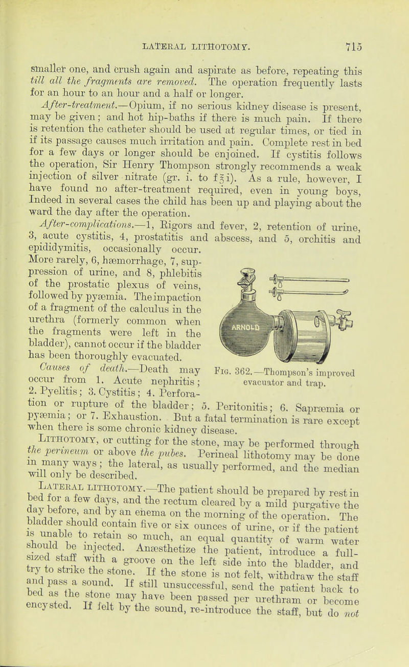 smaller one, and crush again and aspirate as before, repeating this till all the fragments are removed. The operation frequently lasts for an hour to an hour and a half or longer. After-treatment.—Opium, if no serious kidney disease is present, may be given; and hot hip-baths if there is much pain. If there is retention the catheter should be used at regular times, or tied in if its passage causes much irritation and pain. Complete rest in bed for a few days or longer should be enjoined. If cystitis follows the operation, Sir Henry Thompson strongly recommends a weak injection of silver nitrate (gr. i. to fgi). As a rule, however, I have found no after-treatment required, even in young boys, Indeed in several cases the child has been up and playing about the ward the day after the operation. After-complications.—1, Eigors and fever, 2, retention of urine, 3, acute cystitis, 4, prostatitis and abscess, and 5, orchitis and epididymitis, occasionally occur. More rarely, 6, haemorrhage, 7, sup- pression of urine, and 8, phlebitis of the prostatic plexus of veins, followed by pyamiia. The impaction of a fragment of the calculus in the urethra (formerly common when the fragments were left in the bladder), cannot occur if the bladder has been thoroughly evacuated. Causes of death.—Death may occur from 1. Acute nephritis; 2. Pyelitis; 3. Cystitis ; 4. Perfora- tion or rupture of the bladder; 5. Peritonitis; 6. Sapr^mia or pyemia; or 7. Exhaustion. But a fatal termination is rare except ■when there is some chronic kidney disease. Lithotomy, or cutting for the stone, may be performed through the pcnneum or above the pubes. Perineal lithotomy may be done m many ways; the lateral, as usually performed, and the median will only be described. Lateral lithotomy.-The patient should be prepared by rest in dav £l tf' the l eCtum Cleared ^ a mild Purgative the ulut l' 'Tf yfn Tma °n the morninS of the operation. The I i Wo Cf°ntaiU fiVe ? &1X °Unces 0f ^ 01 if P^ieut is unable to retain so much, an equal quantity of warm water stdstS w^- An-ttetize «» l-tient, introduce a full sized staff with a groove on the left side into the bladder and try to strike the stone. If the stone is not felt, withdraw the stnff and pass a sound. If still unsuccessful, send the patient back to encysted. If felt by the sound, re-introduce the staff, but do not Fig. 362.—Thompson's? improved evacuator and trap.