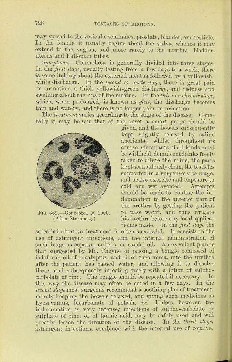 may spread to the vcsiculae seminalos, prostate, 1 (ladder, and testicle. In the female it usually begins about the vulva, whence it may extend to the vagina, and more rarely to the urethra, bladder, uterus and Fallopian tubes. Symptoms.—Gonorrhoea is generally divided into three stages. In the first stage, usually lasting from a few days to a week, there is some itching about the external meatus followed by a yellowish- white discharge. In the second or acute stage, there is great pain on urination, a thick yellowish-green discharge, and redness and swelling about the lips of the meatus. In the third or chronic stage, which, when prolonged, is known as gleet, the discharge becomes thin and watery, and there is no longer pain on urination. The treatment varies according to the stage of the disease. Gene- rally it may be said that at the onset a smart purge should be given, and the bowels subsequently kept shghtly relaxed by saline aperients; whilst, throughout its course, stimulants of all kinds must be withheld, demulcent drinks freely taken to dilute the urine, the parts kept scrupulously clean, the testicles supported in a suspensory bandage, and active exercise and exj>08ure to cold and wet avoided. Attempts should be made to confine the in- flammation to the anterior part of the urethra by getting the patient to pass water, and thus irrigate his urethra before any local applica- tion's made. In the first stage the so-called abortive treatment is often successful. It consists in the use of astringent injections, and the internal administration of such drugs as copaiva, cubebs, or sandal oil. An excellent plan is that suggested by Mr. Cheyne of passing a bougie composed of iodoform, oil of eucalyptus, and oil of theobroma, into the urethra after the patient has passed water, and allowing it to dissolve there, and subsequently injecting freely with a lotion of svdpho- carbolate of zinc. The bougie should be repeated if necessary. In this way the disease may often be cured in a few days. In the second stage most surgeons recommend a soothing plan of treatment, merely keeping the bowels relaxed, and giving such medicine.s as hyoscyamus, bicarbonate of potash, &c. Unless, however, the inflammation is very intense,* injections of sulpho-carbolate or sulphate of zinc, or of tannic acid, may be safely used, and will greatly lessen the duration of the disease. In the third sing**. astringent injections, combined with the internal use of copaiva, Fig. 369.—Gonococci. X 1000. (After Sternberg.)