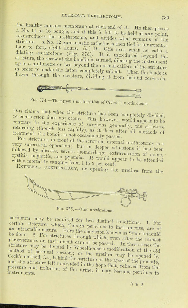 a No 1IT 1 memblianf each end of it. He then passes a No 14 or 16- bougie and if this is felt to be held at any point le-mtroduces the urethrotome,, and divides what remains of the W i 11 ^Um-elastic ca^ter is then tied in for wenty! four to forty-eight hours, (b.) Dr. Otis uses what he calls a ddatiug urethrotome (Pig. 375). It is introduced beyond the stricture, the screw at the handle is turned, dilating the iXlent up to a mdlimetre or two beyond the normal calibre of the Sure in order to make the latter completely salient. Then the bHde L drawn through the stricture, dividing it from bSdteSSfa plG. 374,-Thompson's modification of Oiviale's urethrotome, treatment, f a bougie is not occasionally passed. External ukethbotomy, . ^ the m,thra from fc Fig. 375.—Otis' urethrotome. an intractable nat J^ HeieThfofT^it0 lnstrumets, are of be done. 2. 1^ TtrmtureTthv °Pf a*?nJ™>™ as Byrne's should perseverance, « ttSt^^^f^ the ^ stricture may be divided bv Whin. P^sed In these cases the method of perineTsection i ' £modlfication of the old and the stricture leffc u^tS!/' 1 I&* &f apeX °f ^prostate, Pressure and Sh^tf^ £^ ^ «^ instruments. e' ll may become pervious to 3 b 2