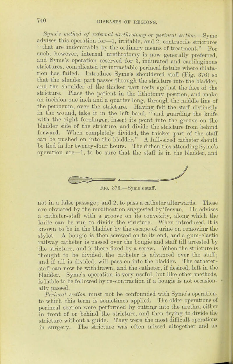 Syme'a metho.d of external urethrotomy or perinea! sedion.Syme advises this operation for—1, irritable, and 2, contractile strictures that are indomitable by tho ordinary means of treatment. For snch, however, internal urethrotomy is now generally preferred, and Syme's operation reserved for 3, indurated and cartilaginous strictures, complicated by intractable perineal fistulas where dilata- tion has failed. Introduce Syme's shouldered staff (Pig. 376) so that the slender part passes through the stricture into the bladder, and the shoulder of the thicker part rests against the face of the stricture. Place the patient in the lithotomy position, and make an incision one inch and a quarter long, through the middle line of the perineum, over the stricture. Having felt the staff distinctly in the wound, take it in the left hand, ' < and guarding the knife with the right forefinger, insert its point into the groove on the bladder side of the stricture, and divide the stricture from behind forward. When completely divided, the thicker part of the staff can be pushed on into the bladder. A full-sized catheter should be tied in for twenty-four hours. The difficulties attending Syme's operation are—1, to be sure that the staff is in the bladder, and Fig. 376.—Syme's staff. not in a false passage ; and 2, to pass a catheter afterwards. These are obviated by the modification suggested by Teevan. He advises a catheter-staff with a groove on its convexity, along which the knife can be run to divide the stricture. When introduced, it is known to be in the bladder by the escape of urine on removing the stylet. A bougie is then screwed on to its end, and a gum-elastic railway catheter is passed over the bougie and staff till arrested by the stricture, and is there fixed by a screw. When the stricture is thought to be divided, the catheter is advanced over the staff; and if all is divided, will pass on into the bladder. The catheter- staff can now be withdrawn, and the catheter, if desired, left in the bladder. Syme's operation is very useful, but like other methods, is liable to be followed by re-contraction if a bougie is not occasion- ally passed. Perineal section must not be confounded with Syme's operation, to which this term is sometimes applied. The older operations of perineal section were performed by cutting into the urethra either in front of or behind the stricture, and then trying to divide the stricture without a guide. They were the most difficult operations in surgery. The stricture was often missed altogether and an