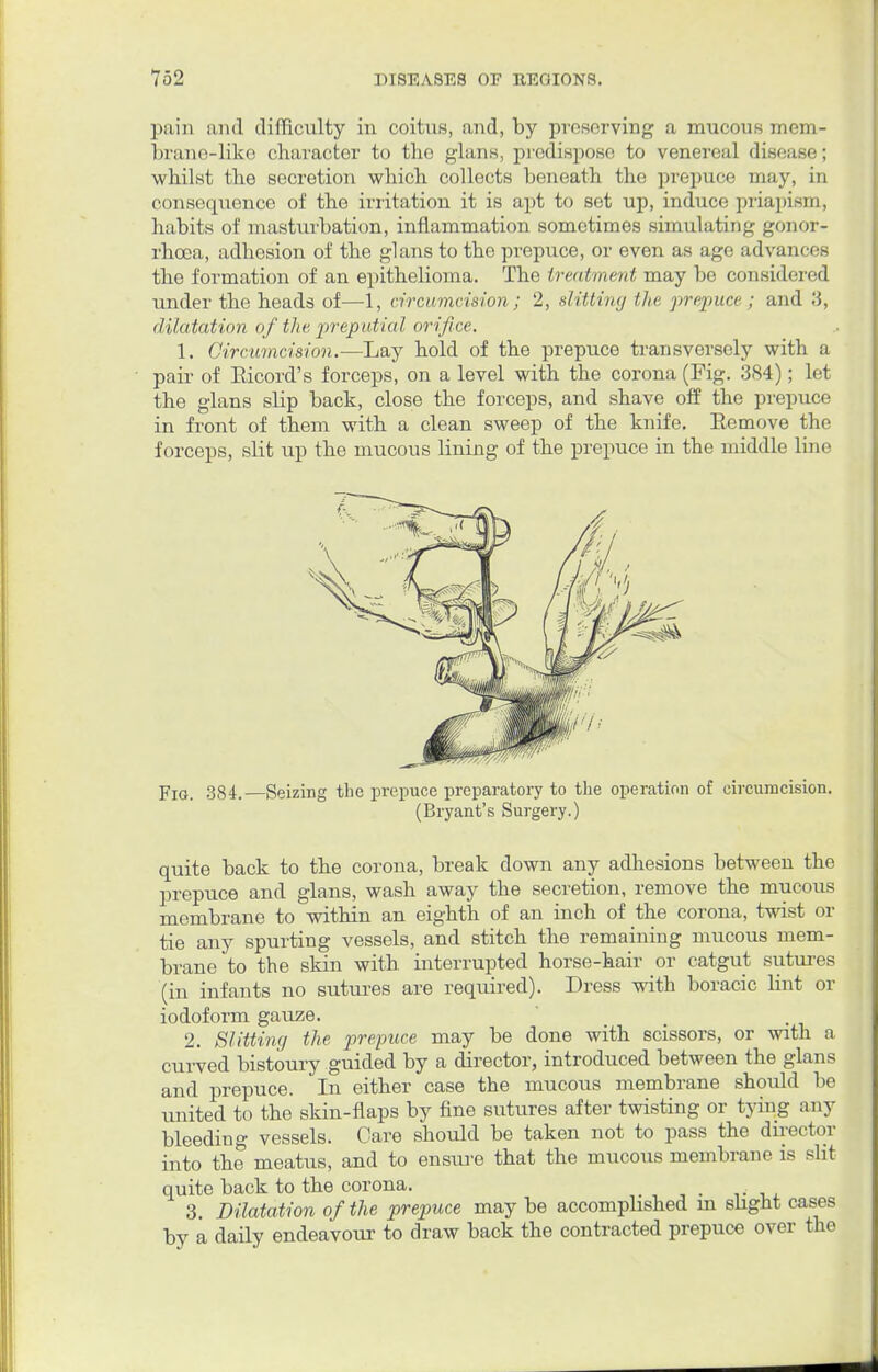 pain iiinl difficulty in coitus, and, by preserving a mucous mem- brane-like character to the glans, predispose to venereal disease; whilst the secretion which collects beneath tin- prepuce may, in consequence of the irritation it is apt to set up, induce priapism, habits of masturbation, inflammation sometimes simulating gonor- rhoea, adhesion of the glans to the prepuce, or even as age advances the formation of an epithelioma. The trcitlincni may be considered under the heads of—1, circumcision ; 2, slitting the prepuce ; and 3, dilatation of the preputial orifice. 1. Circumcision.—Lay hold of the prepuce transversely with a pair of Eicord's forceps, on a level with the corona (Pig. 384); let the glans slip back, close the forceps, and shave off the prepuce in front of them with a clean sweep of the knife. Remove the forceps, slit up the mucous lining of the prepuce in the middle line Fig. 384.—Seizing the prepuce preparatory to the operation of circumcision. (Bryant's Surgery.) quite back to the corona, break down any adhesions between the prepuce and glans, wash away the secretion, remove the mucous membrane to within an eighth of an inch of the corona, twist or tie any spurting vessels, and stitch the remaining mucous mem- brane to the skin with interrupted horse-hair or catgut sutures (in infants no sutures are required). Dress with boracic lint or iodoform gauze. 2. Slitting the prepuce may be done with scissors, or with a curved bistoury guided by a director, introduced between the glans and prepuce. In either case the mucous membrane should be united to the skin-flaps by fine sutures after twisting or tying any bleeding vessels. Care should be taken not to pass the director into the meatus, and to ensure that the mucous membrane is slit- quite back to the corona. 3. Dilatation of the prepuce may be accomplished in slight cases by a daily endeavour to draw back the contracted prepuce over the