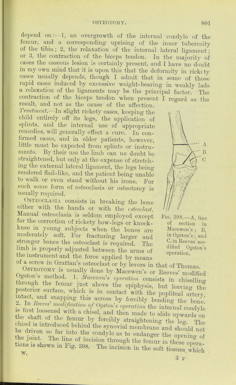 depend on:—1, an overgrowth of the internal condyle of the femur, and a corresponding uprising of the inner' tuberosity of the tibia; 2, the relaxation of the internal lateral ligament; or 3, the contraction of the biceps tendon. In the majority of cases the osseous lesion is certainly present, and I have no doubt in my own mind that it is upon this that the deformity in rickt ty cases usually depends, though I admit that in some of those rapid cases induced by excessive weight-bearing in weakly lads a relaxation of the ligaments may be the principal factor. The contraction of the biceps tendon when present I regard as the result, and not as the cause of the affection. Treatment.—In slight rickety cases, keeping the child entirely off its legs, the application of splints, and the internal use of appropriate remedies, will generally effect a cure. In con- firmed cases, and in older patients, however, little must be expected from splints or instru- ments. By their use the limb can no doubt be straightened, but only at the expense of stretch- ing the external lateral ligament, the legs being rendered flail-like, and the patient being unable to walk or even stand without his irons. Eor such some form of osteoclasia or osteotomy is usually required. < Osteoclasia consists in breaking the bone cither with the hands or with the osteoclast. Manual osteoclasia is seldom employed except for the correction of rickety bow-legs or knock- knee in young subjects when the bones are moderately soft. For fracturing larger and stronger bones the osteoclast is required. The limb is properly adjusted between the arms of the instrument and the force applied by means of a screw m Grattan's osteoclast or by levers in that of Thomas Osteotomy is usually done by Macewen's or Beeves' modified SuT z) hMrr« °rati™ » tniough the femur just above the epiphysis, but leavino- the posterior surface, which is in contact Vith the popliteal arte-y ntact and snapping this across by forcibly bending the bone' 2 In Beeves modification of Ogston's operation the internal condyle' » first loosened wxth a chisel, and then made to slide upwards on the shaft of the femur by forcibly straightening the C The chisel is introduced behind the synovial membrane\nd sWd no? ba driven so far into the condyle as to endanger the openit o he joint The line of incision through the femur in these opera tions as shown m Fig. 398. The incision in the soft Was wh ch Fig. 398.—A, line of section in Macewen's ; J5, in Ogston's; ami C. in Reeves'mo- dified Ogston's operation. 3 v