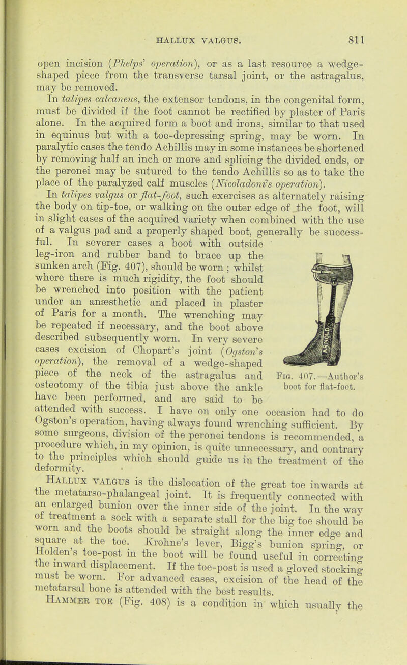 open incision (Phelps' operation), or as a last resource a wedge- shaped piece from the transverse tarsal joint, or the astragalus, may be removed. In talipes calcaneus, the extensor tendons, in the congenital form, must he divided if the foot cannot be rectified by plaster of Paris alone. In the acquired form a boot and irons, similar to that used in equinus but with a toe-depressing spring, may be worn. In paralytic cases the tendo Achillis may in some instances be shortened by removing half an inch or more and splicing the divided ends, or the peronei may be sutured to the tendo Achillis so as to take the place of the paralyzed calf muscles (Nicoladoni's operation). In talipes valgus or flat-foot, such exercises as alternately raising the body on tip-toe, or walking on the outer edge of . the foot, will in slight cases of the acquired variety when combined with the use of a valgus pad and a properly shaped boot, generally be success- ful. In severer cases a boot with outside leg-iron and rubber band to brace up the | » sunken arch (Fig. 407), should be worn ; whilst J||g||| where there is much rigidity, the foot should ^pljBgi be wrenched into position with the patient 1 JTW under an anaesthetic and placed in plaster I / of Paris for a month. The wrenching may LA/ be repeated if necessary, and the boot above jf^i described subsequently worn, [n very severe jMmm cases excision of Chopart's joint (Ogston's --wmMw operation), the removal of a' wedge-shaped ^MP^fe* piece of the neck of the astragalus and Fig. 407.—Author's osteotomy of the tibia just above the ankle hoot for flat-foot, have been performed, and are said to be attended with success. I have on only one occasion had to do Ogston's operation, having always found wrenching sufficient. 1 ly some surgeons, division of the peronei tendons is recommended, a procedure which, in my opinion, is quite unnecessary, and contrary to the principles which should guide us in the treatment of the deformity. Hallux valgus is the dislocation of the great toe inwards at the metatarso-phalangeal joint, It is frequently connected with an enlarged bunion over the inner side of the joint. In the way of treatment a sock with a separate stall for the big toe should be worn and the boots should be straight along the inner edge and square at the toe. Krohne's lever, Bigg's bunion spring, or Jlolden s toe-post in the boot will be found useful in correcting the inward displacement. If the toe-post is used a gloved stocking must bo worn. For advanced cases, excision of the head of the metatarsal bone is attended with the best results. Hammer toe (Fig. 408) is a condition in which usually the