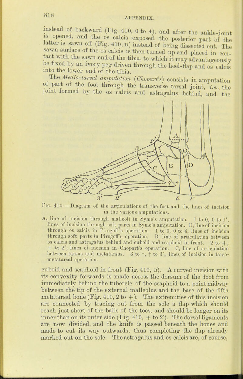 AH'KNIUX. instead of backward (Fig. 410, 0 to 4), and after the ankle-joint is opened, and the os calcis exposed, the posterior part of the latter is sawn off (Fig. 410, d) instead of being dissected out. The sawn surface of the os calcis is then turned up and placed in con- tact with the sawn end of the tibia, to which it may advantageously be fixed by an ivory peg driven through the heel-flap and os calcis into the lower end of the tibia. The Medio-tarsal amputation (Chopart's) consists in amputation ot part of the foot through the transverse tarsal joint, i.e the joint formed by the os calcis and astragalus behind, and' the Fig. 410.—Diagram of the articulations of the foot and the lines of incision in the various amputations. A, line of incision through malleoli in Syme's amputation. 1 to 0, 0 to 1', lines of incision through soft parts in Syme's amputation. D, line of incision through os calcis in Pirogoff's operation. 1 to 0, 0 to 4, lines of incision through soft parts in Pirogoff's operation. B, line of articulation between os calcis and astragalus behind and cuboid and scaphoid in front. 2 to +, + to 2', lines of incision in Chopart's operation. C, line of articulation between tarsus and metatarsus. 3 to f, f to 3', lines of incision in tarso- metatarsal operation. cuboid and scaphoid in front (Fig. 410, b). A curved incision with its convexity forwards is made across the dorsum of the foot from immediately behind the tubercle of the scaphoid to a point midway between the tip of the external malleolus and the base of the fifth metatarsal bone (Fig. 410, 2 to +). The extremities of this incision are connected by tracing out from the sole a flap which should reach just short of the balls of the toes, and should be longer on its inner than on its outer side (Fig. 410, + to 2'). The dorsal ligaments are now divided, and the knife is passed beneath the bones and made to cut its way outwards, thus completing the flap already marked out on the sole. The astragalus and os calcis are, of course,