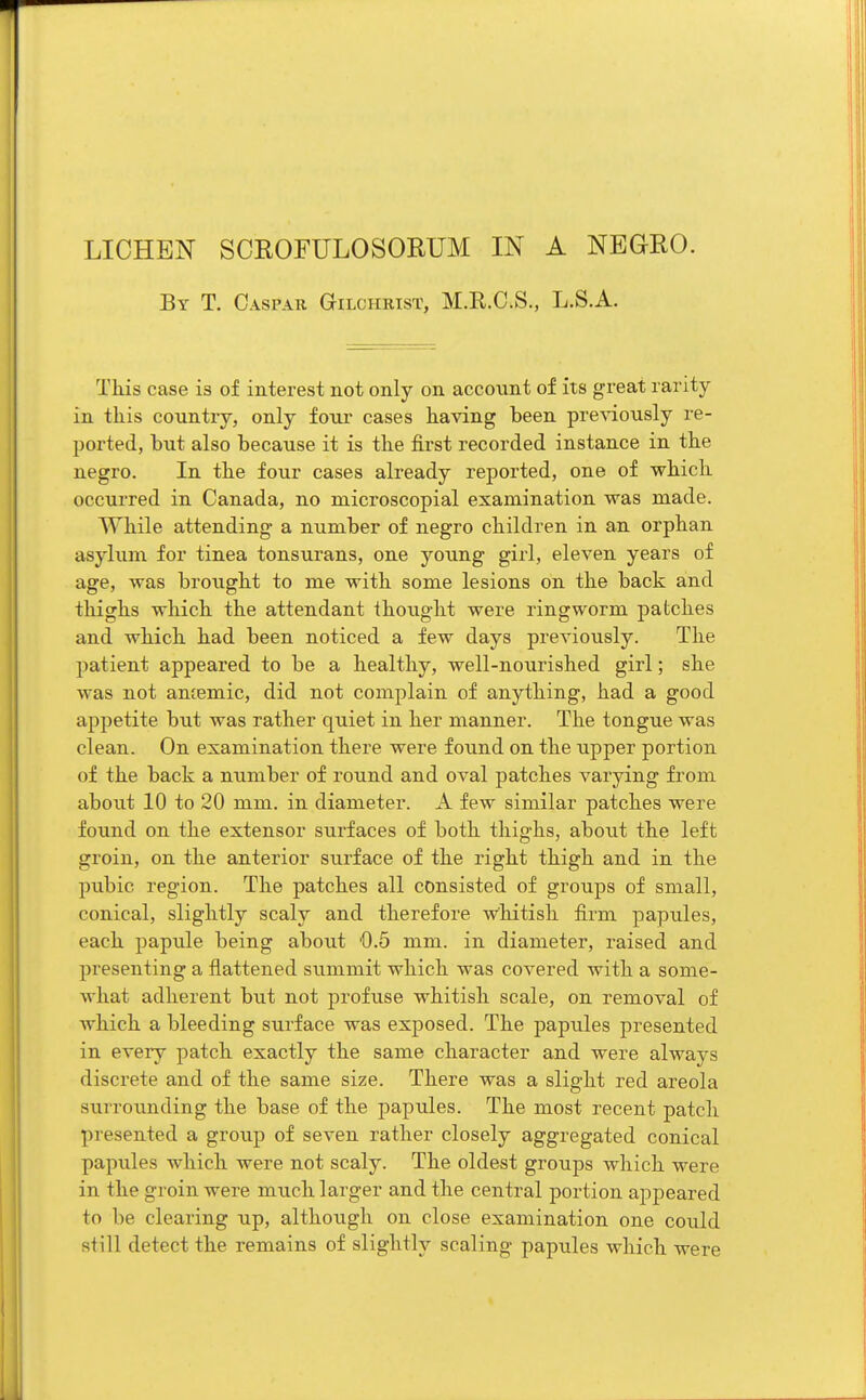 By T. Caspar Gilchrist, M.R.C.S., L.S.A. This case is of interest not only on account of its great rarity in this country, only four cases having been previously re- ported, but also because it is the first recorded instance in the negro. In the four cases already reported, one of which occurred in Canada, no niicroscopial examination was made. While attending a number of negro children in an orphan asylum for tinea tonsurans, one young girl, eleven years of age, was brought to me with some lesions on the back and thighs which the attendant thought were ringworm patches and which had been noticed a few days previously. The patient appeared to be a healthy, well-nourished girl; she was not amemic, did not complain of anything, had a good appetite but was rather quiet in her manner. The tongue was clean. On examination there were found on the upper portion of the back a number of round and oval patches varying from about 10 to 20 mm. in diameter. A few similar patches were found on the extensor surfaces of both thighs, about the left groin, on the anterior surface of the right thigh and in the pubic region. The patches all consisted of groups of small, conical, slightly scaly and therefore whitish firm papules, each papule being about 0.5 mm. in diameter, raised and presenting a flattened summit which was covered with a some- what adherent but not profuse whitish scale, on removal of which a bleeding surface was exposed. The papules presented in every patch exactly the same character and were always discrete and of the same size. There was a slight red areola surrounding the base of the papules. The most recent patch presented a group of seven rather closely aggregated conical papules which were not scaly. The oldest groups which were in the groin were much larger and the central portion appeared to be clearing up, although on close examination one could still detect the remains of slightly scaling papules which were