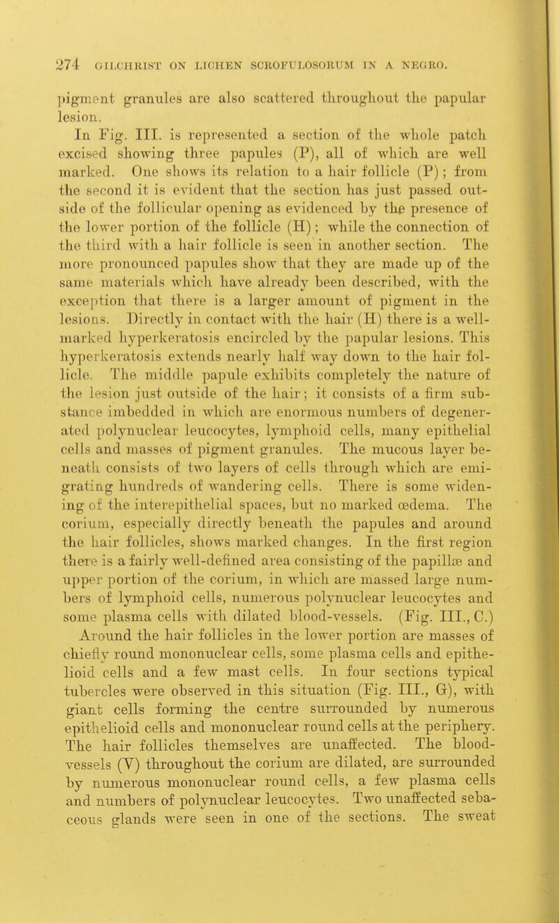 pigment granules are also scattered throughout the papular lesion. In Fig. III. is represented a section of the whole patch excised showing three papules (P), all of which are well marked. One shows its relation to a hair follicle (P); from the second it is evident that the section has just passed out- side of the follicular opening as evidenced by the presence of the lower portion of the follicle (H); while the connection of the third with a hair follicle is seen in another section. The more pronounced papules show that they are made up of the same materials which have already been described, with the exception that there is a larger amount of pigment in the lesions. Directly in contact with the hair (H) there is a well- marked hyperkeratosis encircled by the papular lesions. This hyperkeratosis extends nearly half way down to the hair fol- licle. The middle papule exhibits completely the nature of the lesion just outside of the hair; it consists of a firm sub- stance imbedded in which are enormous numbers of degener- ated polynuclear leucocytes, lymphoid cells, many epithelial cells and masses of pigment granules. The mucous layer be- neath consists of two layers of cells through which are emi- grating hundreds of wandering cells. There is some widen- ing of the interepithelial spaces, but no marked oedema. The corium, especially directly beneath the papules and around the hair follicles, shows marked changes. In the first region there is a fairly well-defined area consisting of the papillce and upper portion of the corium, in which are massed large num- bers of lymphoid cells, numerous polynuclear leucocytes and some plasma cells with dilated blood-vessels. (Pig. III., C.) Around the hair follicles in the lower portion are masses of chiefly round mononuclear cells, some plasma cells and epithe- lioid cells and a few mast cells. In four sections typical tubercles were observed in this situation (Fig. IIP, G), with giant cells forming the centre surrounded by numerous epithelioid cells and mononuclear round cells at the periphery. The hair follicles themselves are unaffected. The blood- vessels (V) throughout the corium are dilated, are surrounded by numerous mononuclear round cells, a few plasma cells and numbers of polynuclear leucocytes. Two unaffected seba- ceous glands were seen in one of the sections. The sweat