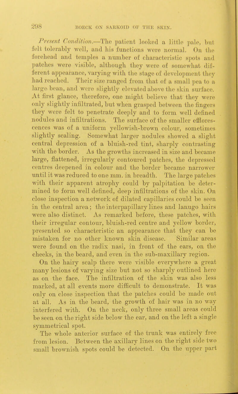 Present Condition.—The patient looked a little pale, bu1 felt tolerably well, and his functions were normal. On the forehead and temples a number of characteristic spots and patches were visible, although they were of somewhat dif- ferent appearance, varying- with the stage of development they had reached. Their size ranged from that of a small pea to a large bean, and were slightly elevated above the skin surface. At first glance, therefore, one might believe that they were only slightly infiltrated, but when grasped between the fingers they were felt to penetrate deeply and to form well defined nodules and infiltrations. The surface of the smaller efflores- cences was of a uniform yellowish-brown colour, sometimes slightly scaling. Somewhat larger nodules showed a slight central depression of a bluish-red tint, sharply contrasting with the border. As the growths increased in size and became hu ge, flattened, irregularly contoured patches, the depressed centres deepened in colour and the border became; narrower until it was reduced to one mm. in breadth. The large patches with their apparent atrophy could by palpitation be deter- mined to form well defined, deep infiltrations of the skin. On close inspection a network of dilated capillaries could be seen in the central area ; theinterpapillarylines and lanugo hairs were also distinct. As remarked before, these patches, with their irregular contour, bluish-red centre and yellow border, presented so characteristic an appearance that they can be mistaken for no other known skin disease. Similar areas were found on the radix nasi, in front of the ears, on the cheeks, in the beard, and even in the sub-maxillary region. On the hairy scalp there were visible everywhere a great many lesions of varying size but not so sharply outlined here as on the face. The infiltration of the skin was also less marked, at all events more difficult to demonstrate. It was only on close inspection that the patches could be made out at all. As in the beard, the growth of hair was in no way interfered with. On the neck, only three small areas could be seen on the right side below the ear, and on the left a single symmetrical spot. The whole anterior surface of the trunk was entirely free from lesion. Between the axillary lines on the right side two small brownish spots could be detected. On the upper part