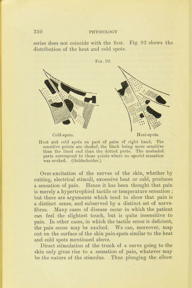series does not coincide with the first. Fig. 92 shows the distribution of the heat and cold spots. Fig. 92. Cold-spots. Heat-spots. Heat and cold spots on part of palm of right hand. The sensitive points are shaded, the black being more sensitive than the lined and than the dotted parts. The unshaded parts correspond to those points where no special sensation was evoked. (Goldscheider.) Over-excitation of the nerves of the skin, whether by cutting, electrical stimuli, excessive heat or cold, produces a sensation of pain. Hence it has been thought that pain is merely a hypertrophied tactile or temperature sensation ; but there are arguments which tend to show that pain is a distinct sense, and subserved by a distinct set of nerve- fibres. Many cases of disease occur in which the patient can feel the slightest touch, but is quite insensitive to pain. In other cases, in which the tactile sense is deficient, the pain sense may be exalted. We can, moreover, map out on the surface of the skin pain-spots similar to the heat and cold spots mentioned above. Direct stimulation of the trunk of a nerve going to the skin only gives rise to a sensation of pain, whatever may be the nature of the stimulus. Thus plunging the elbow