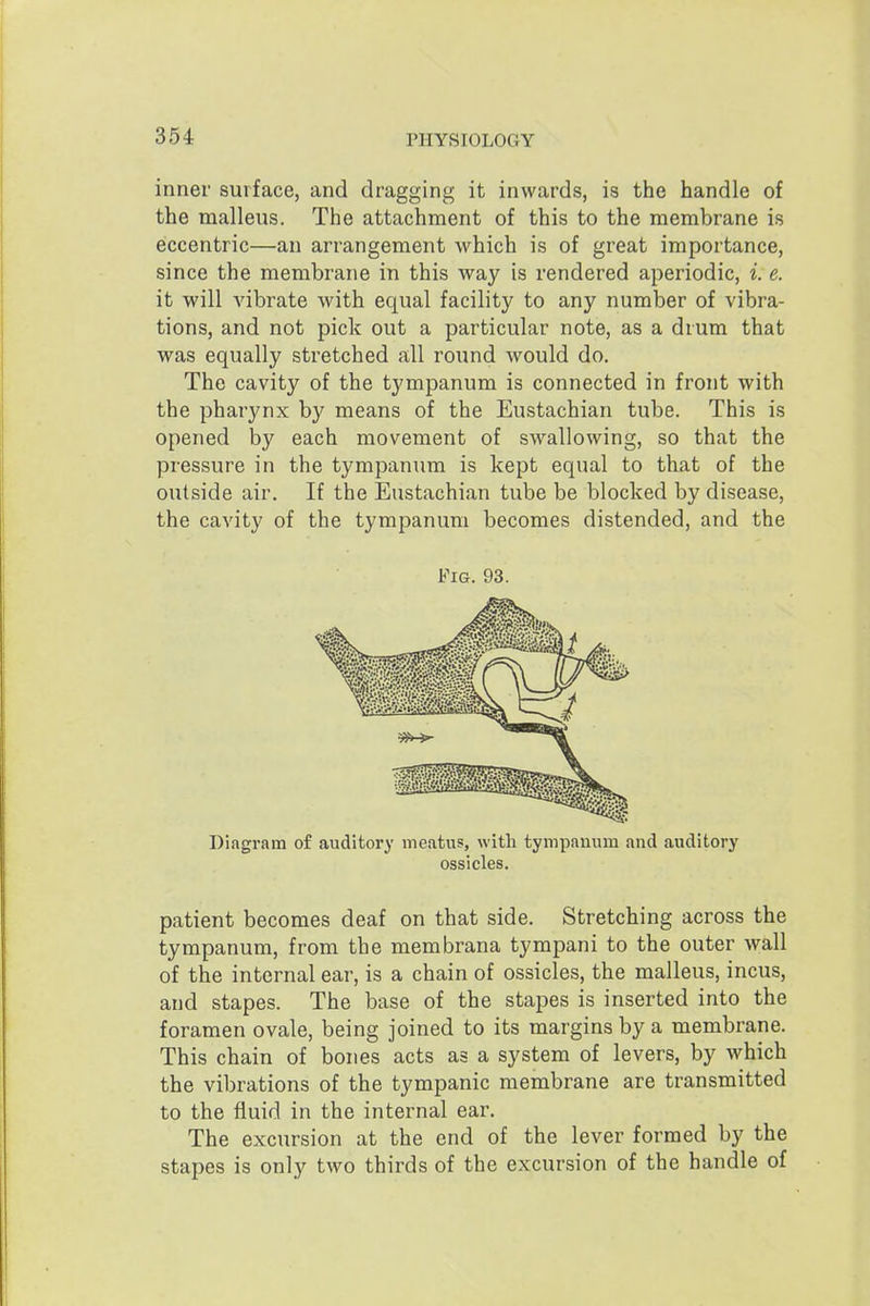 inner surface, and dragging it inwards, is the handle of the malleus. The attachment of this to the membrane is eccentric—an arrangement which is of great importance, since the membrane in this way is rendered aperiodic, i. e. it will vibrate with equal facility to any number of vibra- tions, and not pick out a particular note, as a drum that was equally stretched all round would do. The cavity of the tympanum is connected in front with the pharynx by means of the Eustachian tube. This is opened by each movement of swallowing, so that the pressure in the tympanum is kept equal to that of the outside air. If the Eustachian tube be blocked by disease, the cavity of the tympanum becomes distended, and the Fig. 93. Diagram o£ auditory meatus, with tympanum and auditory ossicles. patient becomes deaf on that side. Stretching across the tympanum, from the membrana tympani to the outer wall of the internal ear, is a chain of ossicles, the malleus, incus, and stapes. The base of the stapes is inserted into the foramen ovale, being joined to its margins by a membrane. This chain of bones acts as a system of levers, by which the vibrations of the tympanic membrane are transmitted to the fluid in the internal ear. The excursion at the end of the lever formed by the stapes is only two thirds of the excursion of the handle of