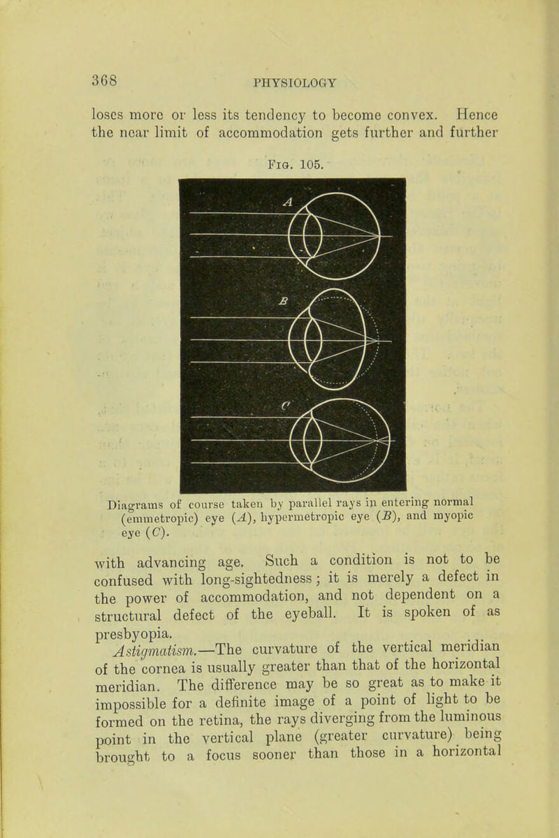 loses more or less its tendency to become convex. Hence the near limit of accommodation gets further and further Fio. 105. Diagrams of course taken by parallel rays in entering normal (emmetropic) eye (A), hypermetropic eye (5), and myopic eye (C). with advancing age. Such a condition is not to be confused with long-sightedness; it is merely a defect in the power of accommodation, and not dependent on a structural defect of the eyeball. It is spoken of as presbyopia. Astigmatism—ThQ curvature of the vertical meridian of the cornea is usually greater than that of the horizontal meridian. The difference may be so great as to make it impossible for a definite image of a point of light to be formed on the retina, the rays diverging from the luminous point in the vertical plane (greater curvature) being brought to a focus sooner than those in a horizontal