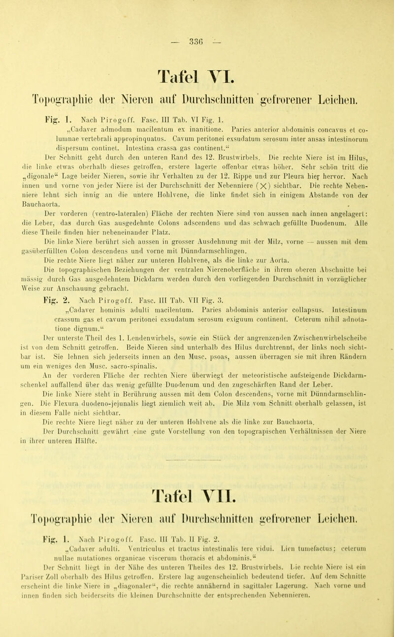 Tafel VI. Toi^ographie der Nieren auf Durclischnitteii gefrorener Leichen. Fig. 1. Nach Pirogoff. Fase. III Tab. VI Fig. 1. „Cadaver admodum macilentum ex inanitione. Paries anterior abdominis concavus et co- lumnae vertebrali appropinquatus. Cavuiii perilonei exsudatum serosum inter ansas intestinorum dispersum continet. Intestina crassa gas continent. Der Schnitt geht durch den unteren Rand des 12. Brustwirbels. Die rechte Niere ist im Hilus, die linlie etwas oberhalb dieses gelrolTen, erstere lagerte oirenliar etwas höher. Sehr schön tritt die „digonale Lage beider Nieren, sowie ihr Verhalten zu der 12. Rippe und zur Pleura hier hervor. Nach innen und vorne von jeder Niere ist der Durchschnitt der Nebenniere (X) sichtbar. Die rechte Neben- niere lehnt sich innig an die untere Hohlvene, die linke findet sich in einigem Abstände von der Bauchaorta. Der vorderen (ventro-lateralen) Fläclie der rechten Niere sind von aussen nach innen angelagert: die Leber, das durch Gas ausgedehnte Colons adscendens und das schwach gefüllte Duodenum. Alle diese Theile finden hier nebeneinander Platz. Die linke Niere berührt sich aussen in grosser Ausdehnung mit der Milz, vorne — aussen mit dem gasüberfüllten Colon descendens und vorne mit Dünndarmschlingen. Die rechte Niere liegt näher zur unteren Ilohlvene, als die linke zur Aorta. Die topographischen Beziehungen der ventralen Nierenoberfläehe in ihrem oberen Abschnitte bei massig durch Gas ausgedehntem Dickdarm werden durch den vorliegenden Durchschnitt in vorzüglicher Weise zur Anschauung gebracht. Fig. 2. Nach Pirogoff. Fase. III Tab. VII Fig. 3. „Cadaver hominis adulti macilentum. Paries abdominis anterior coUapsus. Intestinum crassum gas et cavum peritonei exsudatum serosum exiguum continent. Ceterum nihil adnula- tione dignum. Der unterste Theil des 1. Lendenwirbels, sowie ein Stück der angrenzenden Zwischenwirbelsciieibo ist von dem Schnitt getroffen. Beide Nieren sind unterhalb des Hilus durchtrennt, der links noch sicht- bar ist. Sie lehnen sich jederseits innen an den Muse, psoas, aussen überragen sie mit ihren Rändern um ein weniges den Muse, sacro-spinalis. An der vorderen Fläche der rechten Niere überwiegt der meleoristische aufsteigende Dickdarm- sehenkel auffallend über das wenig gefüllte Duodenum und den zugeschärften Rand der Leber. Die linke Niere steht in Berührung aussen mit dem Colon descendens, vorne mit Dünndarmschlin- gen. Die Flexura duodeno-iejunalis liegt ziemlich weit ab. Die Milz vom Schnitt oberhalb gelassen, ist in diesem Falle nicht sichtbar. Die rechte Niere liegt näher zu der unteren Hohlvene als die linke zur Baucliaorla. Der Durciischnitt gewährt eine gute Vorstellung von den topograpischen Verhältnissen der Niere in ihrer unteren Hälfte. Tafel TU. To|H>grai)hie der Nieren auf Durclischnitten gelrorener Leichen. Fig. 1. Naeii Pirogoff. Fase. III Tab. II Fig. 2. „Cadaver adulii. Venlriculus et tractus intestinalis lere vidui. Licn tumefaotus; ceterum nullae mutaliones organicae viscerum thoracis et abdominis. Der Schnitt liegt in der Nähe des unteren Theiles des 12. Brustwirbels, l ie n'chlc^ Men' i^t ein Pariser Zoll oberhalb des Hilus gotrollVn. lirstere lag augenscheinlich bedeulend tiefer. Auf dem Schnitte erscheint die linke Niere in .,diagonaler, die lechte annähernd in sagittaler Laiierung. Nach vorne und innen linden sich beiderseits die kleinen I»urrhsrhuiiie der entsprerlieinlen Nebennieren.