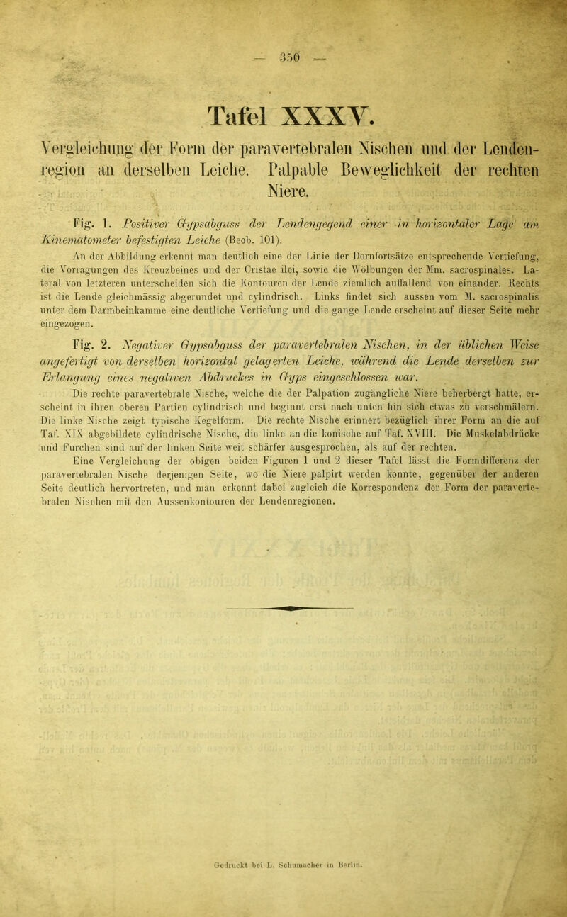 Tafel XXXV. Vergieichung- der Form der paravertebraleii Nischen und der Lendeii- region an derselben Leiche. Palpable Beweglichkeit der rechten Niere. Fig. 1. Positiver Oypsabguss der Lendengegend einer in horizontaler Lage am Kinematonieter befestigten Leiche (Beob. 101). An der Alibililiiiig- erkeiinl man dentlich eine der Linie der Dornfortsäize cnlsprechende Vertiefung, die Vorragungen des Kreuzbeines und der Cristae ilci, sowie die Wölbungen der Mm. sacrospinales. La- teral von letzteren unterscheiden sich die Kontouren der Lende ziendich aulTallend von einander. Rechts ist die Lende gleichmässig abgerundet und cylindrisch. Links findet sicli aussen vom M. sacrospinalis unter dem Darmbeinkamme eine deutliche Vertiefung und die gange Lende erscheint auf dieser Seite mehr eingezogen. Fig. 2. Negativer Gypsabguss der paravertehralen Nischen, in der üblichen Weise angefertigt von derselben horizontal gelagerten Leiche, tvähre^id die Lende derselben zur Erlangung eines negativen Abdruckes in Gyps eingeschlossen war. Die rechte paravertebrale Nische, welche die der Palpation zugängliche Niere beherbergt hatte, er- scheint in ihren oberen Partien cylindrisch und beginnt erst nach unten hin sich etwas zu verschmälern. Die linke Nische zeigt typische Kegelform. Die rechte Nische erinnert bezüglich ihrer Form an die auf Taf. XIX abgebildete cylindrische Nische, die linke an die konische auf Taf. XVIIl. Die Muskelabdrücke und Furchen sind auf der linken Seite weit schärfer ausgesprochen, als auf der rechten. Eine Vergleichung der obigen beiden Figuren 1 und 2 dieser Tafel lässt die FormdifTerenz der paravertebralen Nische derjenigen Seite, wo die Niere palpirt werden konnte, gegenüber der anderen Seite deutlich hervortreten, und man erkennt dabei zugleich die Korrespondenz der Form der paraverte- bralen Nischen mit den Aussenkontouren der Lendenregiouen. Godiiickt Ijei L. Scliuiuiiclicr iii Berlin.