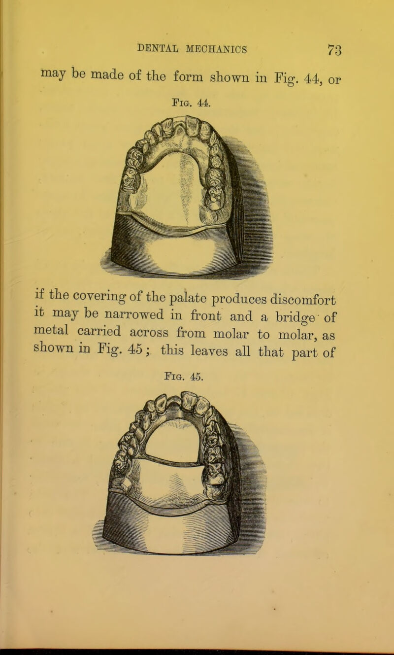 may be made of the form shown in Fig. 44, or Fig. 44. if the covering of the palate produces discomfort it may be narrowed in front and a bridge of metal carried across from molar to molar, as shown in Fig. 45; this leaves all that part of Fig. 45. ■