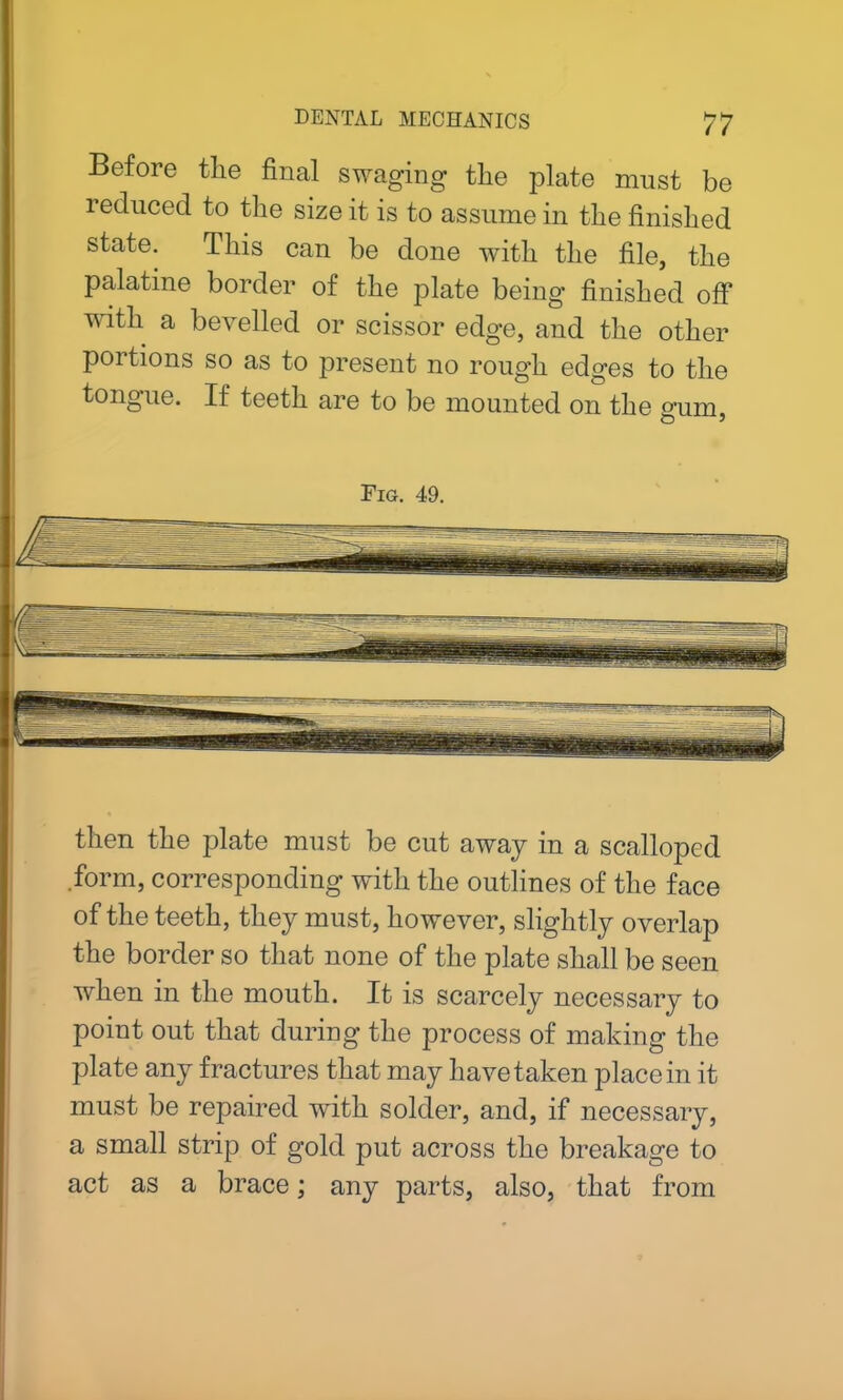 Before the final swaging the plate must be reduced to the size it is to assume in the finished state. This can be done with the file, the palatine border of the plate being finished off with a bevelled or scissor edge, and the other poitions so as to present no rough edges to the tongue. If teeth are to be mounted on the ^um O * Fig. 49. then the plate must be cut away in a scalloped form, corresponding with the outlines of the face of the teeth, they must, however, slightly overlap the border so that none of the plate shall be seen when in the mouth. It is scarcely necessary to point out that during the process of making the plate any fractures that may have taken place in it must be repaired with solder, and, if necessary, a small strip of gold put across the breakage to act as a brace; any parts, also, that from