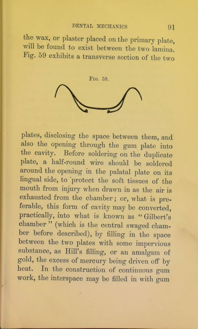 the wax, or plaster placed on the primary plate, will be found to exist between the two lamina. Fig. 59 exhibits a transverse section of the two Fig. 59. W plates, disclosing the space between them, and also the opening through the gum plate into the cavity. Before soldering on the duplicate plate, a half-round wire should be soldered around the opening in the palatal plate on its lingual side, to protect the soft tissues of the mouth from injury when drawn in as the air is exhausted from the chamber; or, what is pre- ferable, this form of cavity may be converted, practically, into what is known as “ Gilbert’s chamber ” (which is the central swaged cham- ber before described), by filling in the space between the two plates with some impervious substance, as Hill’s filling, or an amalgam of gold, the excess of mercury being driven off by heat. In the construction of continuous gum work, the interspace may be filled in with gum