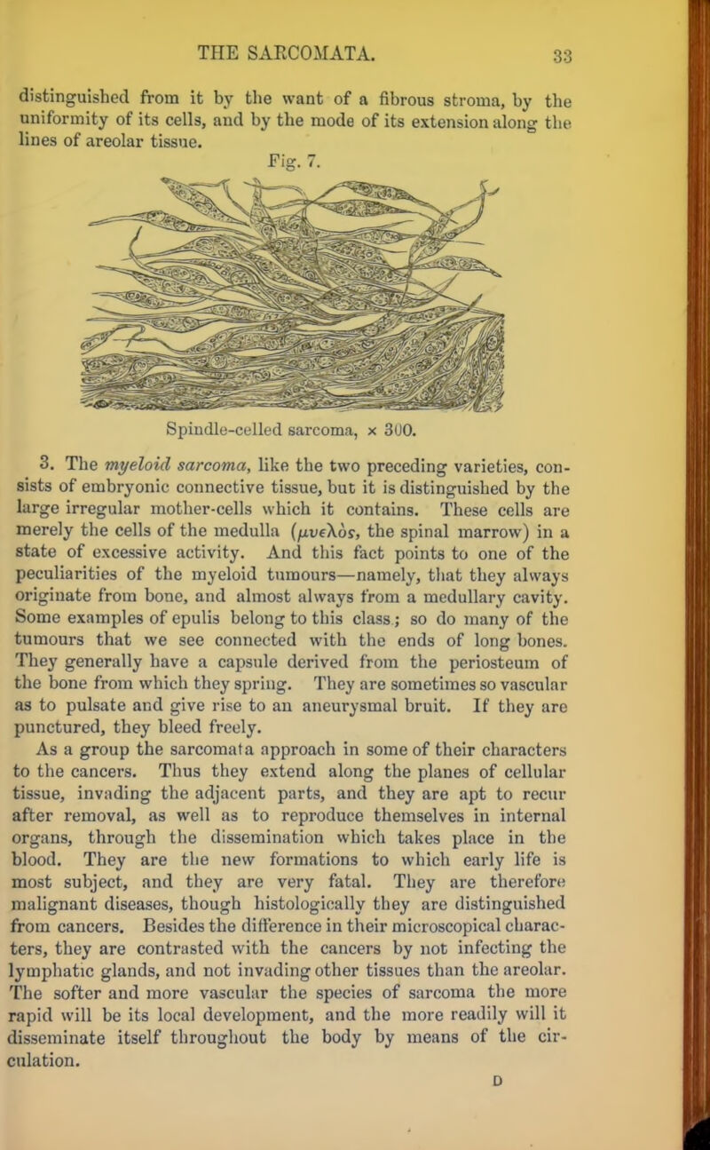 distinguished from it by the want of a fibrous stroma, by the uniformity of its cells, and by the mode of its extension along the lines of areolar tissue. Fig. 7. Spindle-celled sarcoma, x 3U0. 3. The myeloid sarcoma, like the two preceding varieties, con- sists of embryonic connective tissue, but it is distinguished by the larse irregular mother-cells which it contains. These cells are merely the cells of the medulla (fivekos, the spinal marrow) in a state of excessive activity. And this fact points to one of the peculiarities of the myeloid tumours—namely, that they always originate from bone, and almost always from a medullary cavity. Some examples of epulis belong to this class; so do many of the tumours that we see connected with the ends of long bones. They generally have a capsule derived from the periosteum of the bone from which they spring. They are sometimes so vascular as to pulsate and give rise to an aneurysmal bruit. If they are punctured, they bleed freely. As a group the sarcomata approach in some of their characters to the cancers. Thus they extend along the planes of cellular tissue, invading the adjacent parts, and they are apt to recur after removal, as well as to reproduce themselves in internal organs, through the dissemination which takes place in the blood. They are the new formations to which early life is most subject, and they are very fatal. They are therefore malignant diseases, though histologically they are distinguished from cancers. Besides the difference in their microscopical charac- ters, they are contrasted with the cancers by not infecting the lymphatic glands, and not invading other tissues than the areolar. The softer and more vascular the species of sarcoma the more rapid will be its local development, and the more readily will it disseminate itself throughout the body by means of the cir- culation. D