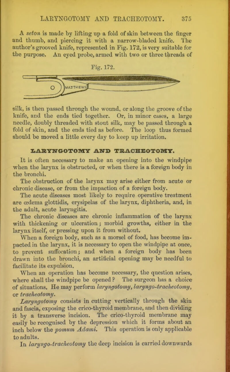 A seton is made by lifting up a fold of skin between tbe finger and thumb, and piercing it with a narrow-bladed knife. The author's grooved knife, represented in Fig. 172, is very suitable for the purpose. An eyed probe, armed with two or three threads of Fig. 172. silk, is then passed through the wound, or along the groove of the knife, and the ends tied together. Or, in minor cases, a large needle, doubly threaded with stout silk, may be passed through a fold of skin, and the ends tied as before. The loop thus formed should be moved a little every day to keep up irritation. LARYNGOTOMY AND TRACHEOTOMY. It is often necessary to make an opening into the windpipe when the larynx is obstructed, or when there is a foreign body in the bronchi. The obstruction of the larynx may arise either from acute or chronic disease, or from the impaction of a foreign body. The acute diseases most likely to require operative treatment are oedema glottidis, erysipelas of the larynx, diphtheria, and, in the adult, acute laryngitis. The chronic diseases are chronic inflammation of tbe larynx with thickening or ulceration; morbid growths, either in the larynx itself, or pressing upon it from without. When a foreign body, such as a morsel of food, has become im- pacted in the larynx, it is necessary to open the windpipe at once, to prevent suffocation; and when a foreign body has been drawn into the bronchi, an artificial opening may be needful to facilitate its expulsion. When an operation has become necessary, the question arises, where shall the windpipe be opened ? The surgeon has a choice of situations. He may perform laryngotomy, laryngo-tracheotomy, or tracheotomy. Laryngotomy consists in cutting vertically through the skin and fascia, exposing the crico-thyroid membrane, and then dividing it by a transverse incision. The crico-thyroid membrane may easily be recognised by the depression which it forms about an inch below the pomum Adami. This operation is only applicable to adults. In laryngo-tracheotomy the deep incision is carried downwards