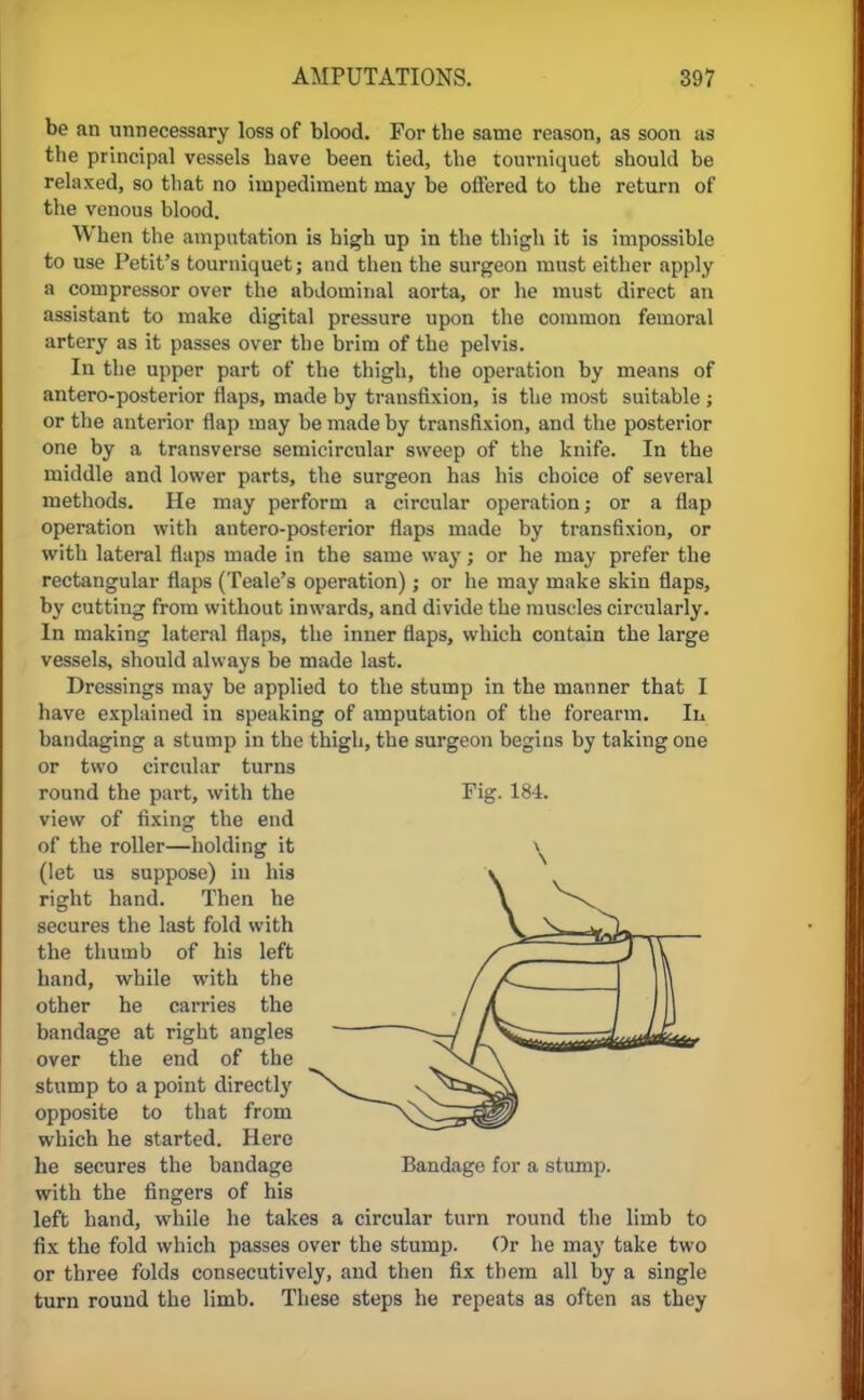 be an unnecessary loss of blood. For the same reason, as soon as the principal vessels have been tied, the tourniquet should be relaxed, so that no impediment may be offered to the return of the venous blood. When the amputation is high up in the thigh it is impossible to use Petit's tourniquet; and then the surgeon must either apply a compressor over the abdominal aorta, or he must direct an assistant to make digital pressure upon the common femoral artery as it passes over the brim of the pelvis. In the upper part of the thigh, the operation by means of antero-posterior flaps, made by transfixion, is the most suitable ; or the anterior flap may be made by transfixion, and the posterior one by a transverse semicircular sweep of the knife. In the middle and lower parts, the surgeon has his choice of several methods. He may perform a circular operation; or a flap operation with antero-posterior flaps made by transfixion, or with lateral flaps made in the same way; or he may prefer the rectangular flaps (Teale's operation); or he may make skin flaps, by cutting from without inwards, and divide the muscles circularly. In making lateral flaps, the inner flaps, which contain the large vessels, should always be made last. Dressings may be applied to the stump in the manner that I have explained in speaking of amputation of the forearm. Iu bandaging a stump in the thigh, the surgeon begins by taking one or two circular turns round the part, with the Fig. 184. view of fixing the end of the roller—holding it (let us suppose) in his right hand. Then he secures the last fold with the thumb of his left hand, while with the other he carries the bandage at right angles over the end of the stump to a point directly opposite to that from which he started. Here lie secures the bandage Bandage for a stump, with the fingers of his left hand, while he takes a circular turn round the limb to fix the fold which passes over the stump. Or he may take two or three folds consecutively, and then fix them all by a single turn round the limb. These steps he repeats as often as they