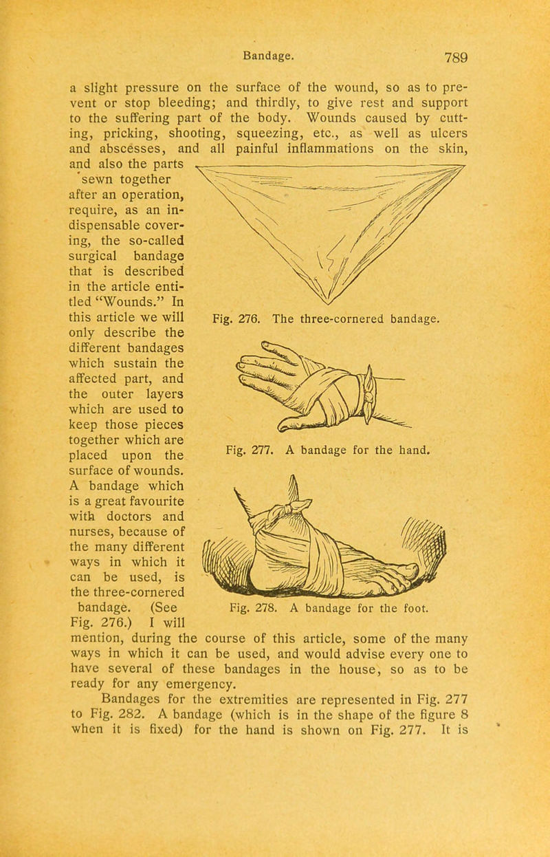 Fig. 276. The three-cornered bandage. a slight pressure on the surface of the wound, so as to pre- vent or stop bleeding; and thirdly, to give rest and support to the suffering part of the body. Wounds caused by cutt- ing, pricking, snooting, squeezing, etc., as well as ulcers and abscesses, and all painful inflammations on the skin, and also the parts 'sewn together after an operation, require, as an in- dispensable cover- ing, the so-called surgical bandage that is described in the article enti- tled Wounds. In this article we will only describe the different bandages which sustain the affected part, and the outer layers which are used to keep those pieces together which are placed upon the surface of wounds. A bandage which is a great favourite with doctors and nurses, because of the many different ways in which it can be used, is the three-cornered bandage. (See Fig. 276.) I will mention, during the course of this article, some of the many ways in which it can be used, and would advise every one to have several of these bandages in the house, so as to be ready for any emergency. Bandages for the extremities are represented in Fig. 277 to Fig. 282. A bandage (which is in the shape of the figure 8 when it is fixed) for the hand is shown on Fig. 277. It is Fig. 277. A bandage for the hand. Fig. 278. A bandage for the foot.