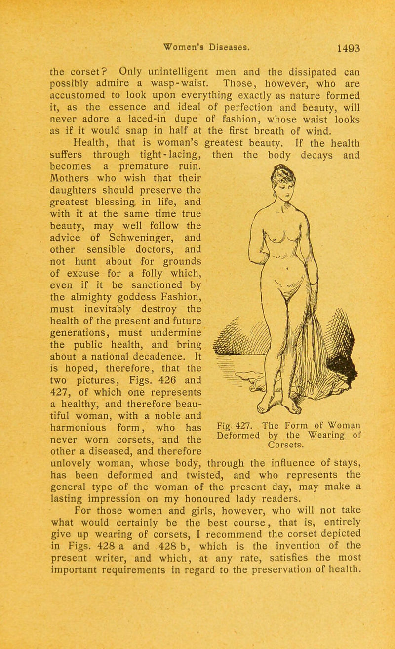 the corset? Only unintelligent men and the dissipated can possibly admire a wasp-waist. Those, however, who are accustomed to look upon everything exactly as nature formed it, as the essence and ideal of perfection and beauty, will never adore a laced-in dupe of fashion, whose waist looks as if it would snap in half at the first breath of wind. Health, that is woman's greatest beauty. If the health suffers through tight-lacing, then the body decays and becomes a premature ruin. Mothers who wish that their daughters should preserve the greatest blessing, in life, and with it at the same time true beauty, may well follow the advice of Schweninger, and other sensible doctors, and not hunt about for grounds of excuse for a folly which, even if it be sanctioned by the almighty goddess Fashion, must inevitably destroy the health of the present and future generations, must undermine the public health, and bring about a national decadence. It is hoped, therefore, that the two pictures, Figs. 426 and 427, of which one represents a healthy, and therefore beau- tiful woman, with a noble and harmonious form, who has never worn corsets, and the other a diseased, and therefore Fig. 427. The Form of Woman Deformed by the Wearing of Corsets. unlovely woman, whose body, through the influence of stays, has been deformed and twisted, and who represents the general type of the woman of the present day, may make a lasting impression on my honoured lady readers. For those women and girls, however, who will not take what would certainly be the best course, that is, entirely give up wearing of corsets, I recommend the corset depicted in Figs. 428 a and 428 b, which is the invention of the present writer, and which, at any rate, satisfies the most important requirements in regard to the preservation of health.