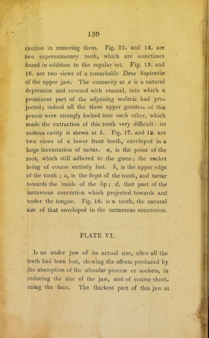 caution in removing them. Fig. 13. and 14. are two supernumerary teeth, which are sometimes found in addition to the regular set. Fig. 15. and 16. are two views of a remarkable Dens Sapientia: of the upper jaw. The concavity at a is a natural depression and covered with enamel, into which a prominent part of the adjoining molaris had pro- jected; indeed all the three upper grinders of this person were strongly locked into each other, which made the extraction of this tooth very difficult: its carious cavity is shewn at b. Fig. 17. and 18. are two views of a lower front tooth, enveloped in a large incrustation of tartar, a, is the point of the root, which still adhered to the gums; the socket being of course entirely lost, b, is the upper edge of the tooth ; c, is the front of the tooth, and tartar towards the inside of the lip ; d, that part of the tartareous concretion which projected towards and under the tongue. Fig. 18. is a tooth, the natural size of that enveloped in the tartareous concretion. PLATE VI. Is an under jaw of its actual size, after all the teeth had been lost, shewing the effects produced by the absorption of the alveolar process or sockets, in reducing the size of the jaw, and of course short- ening the face. The thickest part of this jaw' at