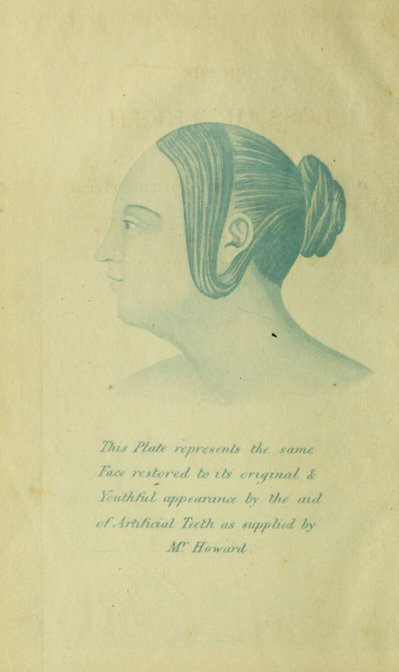 /his //ate represents t/te same Fate restored to its original <£ b »?htv,l appearance by- the aid of Artificial Teeth as supplied by AP^ Ho H ard