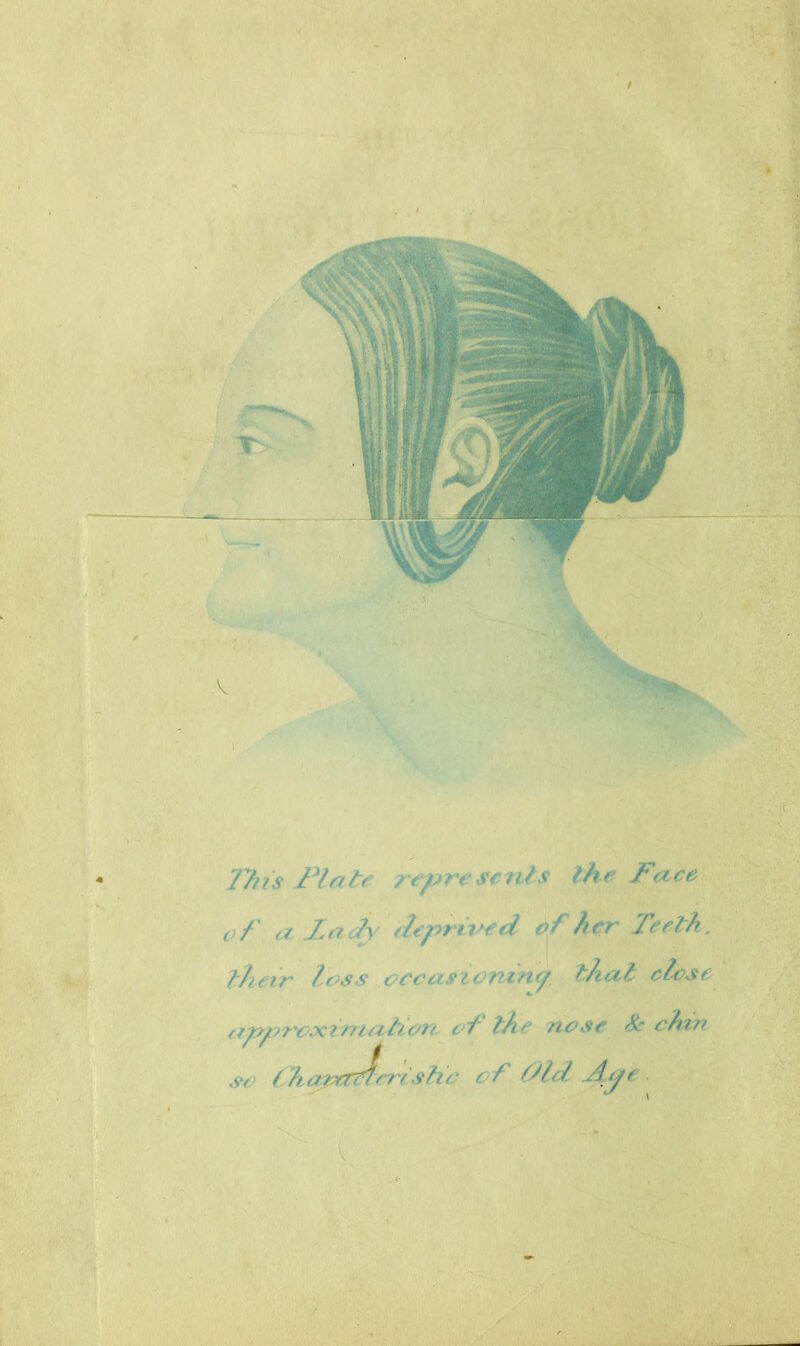 This Plate represents the Face of a lady deprived of her Teeth, their loss occasioning tha,l close the ncse A emu SC ihtvrtrlr/.vhr tof Old A<je