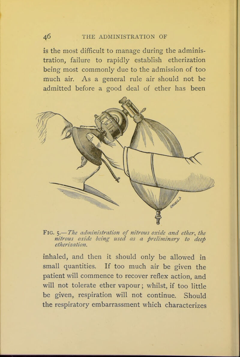 is the most difficult to manage during the adminis- tration, failure to rapidly establish etherization being most commonly due to the admission of too much air. As a general rule air should not be admitted before a good deal of ether has been Fig. 5.— The administration of nitrous oxide and ether^ the nitrous oxide being used as a preliminary to deep etherization. inhaled, and then it should only be allowed in small quantities. If too much air be given the patient will commence to recover reflex action, and will not tolerate ether vapour; whilst, if too little be given, respiration will not continue. Should the respiratory embarrassment which characterizes