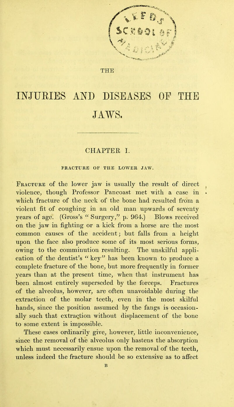 THE INJURIES AND DISEASES OF THE JAWS. CHAPTER I. FRACTURE OF THE LOWER JAW. Fracture of the lower jaw is usually the result of direct violence, though Professor Pancoast met with a case in which fracture of the neck of the bone had resulted from a violent fit of coughing in an old man upwards of seventy- years of age. (Gross's  Surgery/' p. 964.) Blows received on the jaw in fighting or a kick from a horse are the most common causes of the accident; but falls from a height upon the face also produce some of its most serious forms, owing to the comminution resulting. The unskilful appli- cation of the dentist's key has been known to produce a complete fracture of the bone, but more frequently in former years than at the present time, when that instrument has been almost entirely superseded by the forceps. Fractures of the alveolus, however, are often unavoidable during the extraction of the molar teeth, even in the most skilful hands, since the position assumed by the fangs is occasion- ally such that extraction without displacement of the bone to some extent is impossible. These cases ordinarily give, however, little inconvenience, since the removal of the alveolus only hastens the absorption which must necessarily ensue upon the removal of the teeth, unless indeed the fracture should be so extensive as to affect B