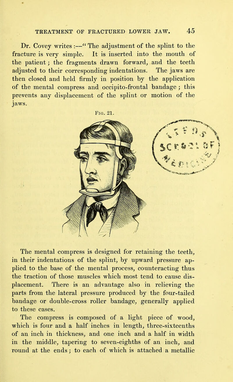 Dr. Covey writes :— The adjustment of the splint to the fracture is very simple. It is inserted into the mouth of the patient; the fragments drawn forward, and the teeth adjusted to their corresponding indentations. The jaws are then closed and held firmly in position by the application of the mental compress and occipito-frontal bandage ; this prevents any displacement of the splint or motion of the jaws. The mental compress is designed for retaining the teeth, in their indentations of the splint, by upward pressure ap- plied to the base of the mental process, counteracting thus the traction of those muscles which most tend to cause dis- placement. There is an advantage also in relieving the parts from the lateral pressure produced by the four-tailed bandage or double-cross roller bandage, generally applied to these cases. The compress is composed of a light piece of wood, which is four and a half inches in length, three-sixteenths of an inch in thickness, and one inch and a half in width in the middle, tapering to seven-eighths of an inch, and round at the ends; to each of which is attached a metallic