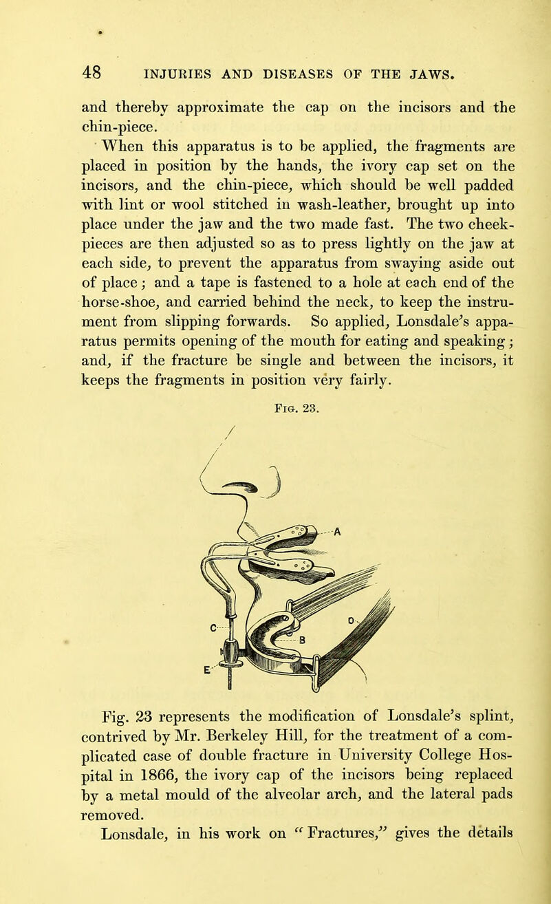 and thereby approximate the cap on the incisors and the chin-piece. When this apparatus is to be applied, the fragments are placed in position by the hands, the ivory cap set on the incisors, and the chin-piece, which should be well padded with lint or wool stitched in wash-leather, brought up into place under the jaw and the two made fast. The two cheek- pieces are then adjusted so as to press lightly on the jaw at each side, to prevent the apparatus from swaying aside out of place; and a tape is fastened to a hole at each end of the horse-shoe, and carried behind the neck, to keep the instru- ment from slipping forwards. So applied, Lonsdale's appa- ratus permits opening of the mouth for eating and speaking; and, if the fracture be single and between the incisors, it keeps the fragments in position very fairly. Pig. 23. / Fig. 23 represents the modification of Lonsdale's splint, contrived by Mr. Berkeley Hill, for the treatment of a com- plicated case of double fracture in University College Hos- pital in 1866, the ivory cap of the incisors being replaced by a metal mould of the alveolar arch, and the lateral pads removed. Lonsdale, in his work on  Fractures, gives the details