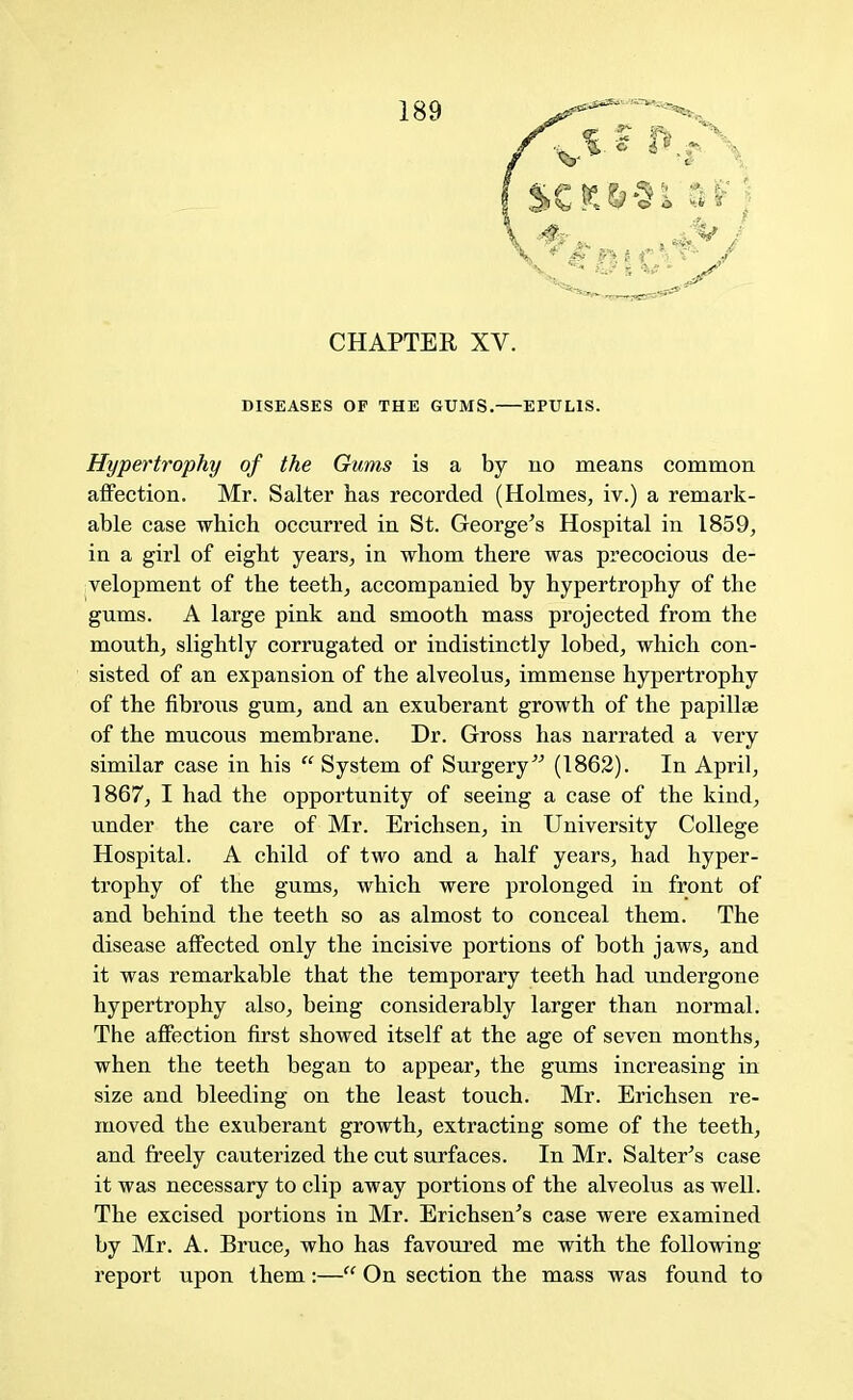 CHAPTER XV. DISEASES OF THE GUMS. EPULIS. Hypertrophy of the Gums is a by no means common affection. Mr. Salter has recorded (Holmes, iv.) a remark- able case which occurred in St. George's Hospital in 1859, in a girl of eight years, in whom there was precocious de- velopment of the teeth, accompanied by hypertrophy of the gums. A large pink and smooth mass projected from the mouth, slightly corrugated or indistinctly lobed, which con- sisted of an expansion of the alveolus, immense hypertrophy of the fibrous gum, and an exuberant growth of the papillae of the mucous membrane. Dr. Gross has narrated a very similar case in his  System of Surgery (1862). In April, 1867, I had the opportunity of seeing a case of the kind, under the care of Mr. Erichsen, in University College Hospital. A child of two and a half years, had hyper- trophy of the gums, which were prolonged in front of and behind the teeth so as almost to conceal them. The disease affected only the incisive portions of both jaws, and it was remarkable that the temporary teeth had undergone hypertrophy also, being considerably larger than normal. The affection first showed itself at the age of seven months, when the teeth began to appear, the gums increasing in size and bleeding on the least touch. Mr. Erichsen re- moved the exuberant growth, extracting some of the teeth, and freely cauterized the cut surfaces. In Mr. Salter's case it was necessary to clip away portions of the alveolus as well. The excised portions in Mr. Erichsen's case were examined by Mr. A. Bruce, who has favoured me with the following report upon them:— On section the mass was found to