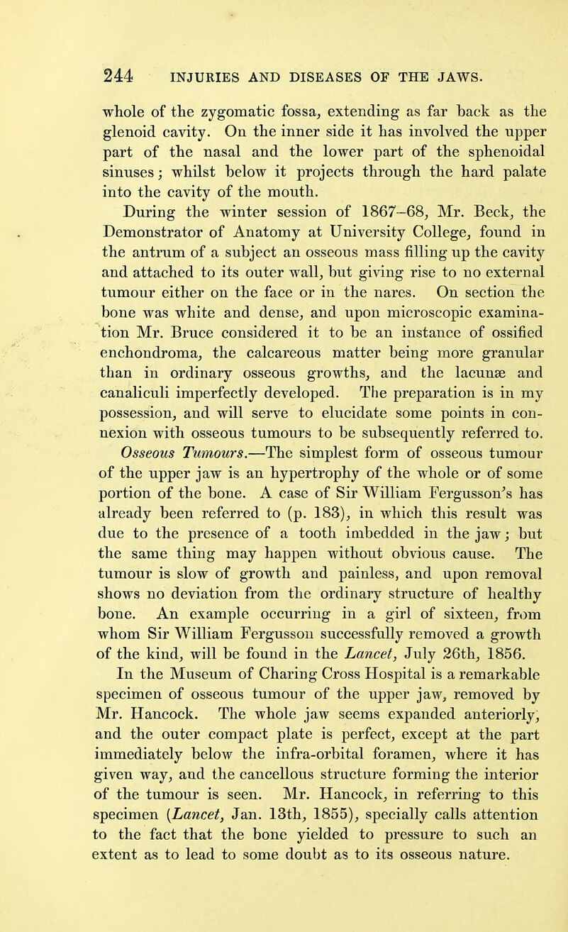 whole of the zygomatic fossa,, extending as far back as the glenoid cavity. On the inner side it has involved the upper part of the nasal and the lower part of the sphenoidal sinuses; whilst below it projects through the hard palate into the cavity of the mouth. During the winter session of 1867—68, Mr. Beck, the Demonstrator of Anatomy at University College, found in the antrum of a subject an osseous mass filling up the cavity and attached to its outer wall, but giving rise to no external tumour either on the face or in the nares. On section the bone was white and dense, and upon microscopic examina- tion Mr. Bruce considered it to be an instance of ossified enchondroma, the calcareous matter being more granular than in ordinary osseous growths, and the lacunae and canaliculi imperfectly developed. The preparation is in my possession, and will serve to elucidate some points in con- nexion with osseous tumours to be subsequently referred to. Osseous Tumours.—The simplest form of osseous tumour of the upper jaw is an hypertrophy of the whole or of some portion of the bone. A case of Sir William Fergusson's has already been referred to (p. 183), in which this result was due to the presence of a tooth imbedded in the jaw; but the same thing may happen without obvious cause. The tumour is slow of growth and painless, and upon removal shows no deviation from the ordinary structure of healthy bone. An example occurring in a girl of sixteen, from whom Sir William Fergusson successfully removed a growth of the kind, will be found in the Lancet, July 26th, 1856. In the Museum of Charing Cross Hospital is a remarkable specimen of osseous tumour of the upper jaw, removed by Mr. Hancock. The whole jaw seems expanded anteriorly, and the outer compact plate is perfect, except at the part immediately below the infra-orbital foramen, where it has given way, and the cancellous structure forming the interior of the tumour is seen. Mr. Hancock, in referring to this specimen {Lancet, Jan. 13th, 1855), specially calls attention to the fact that the bone yielded to pressure to such an extent as to lead to some doubt as to its osseous nature.